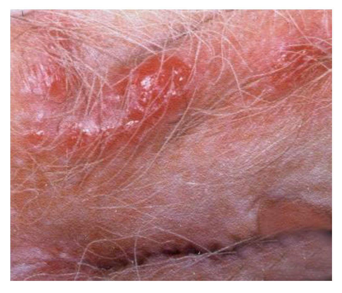 Cancers 14 01822 g004