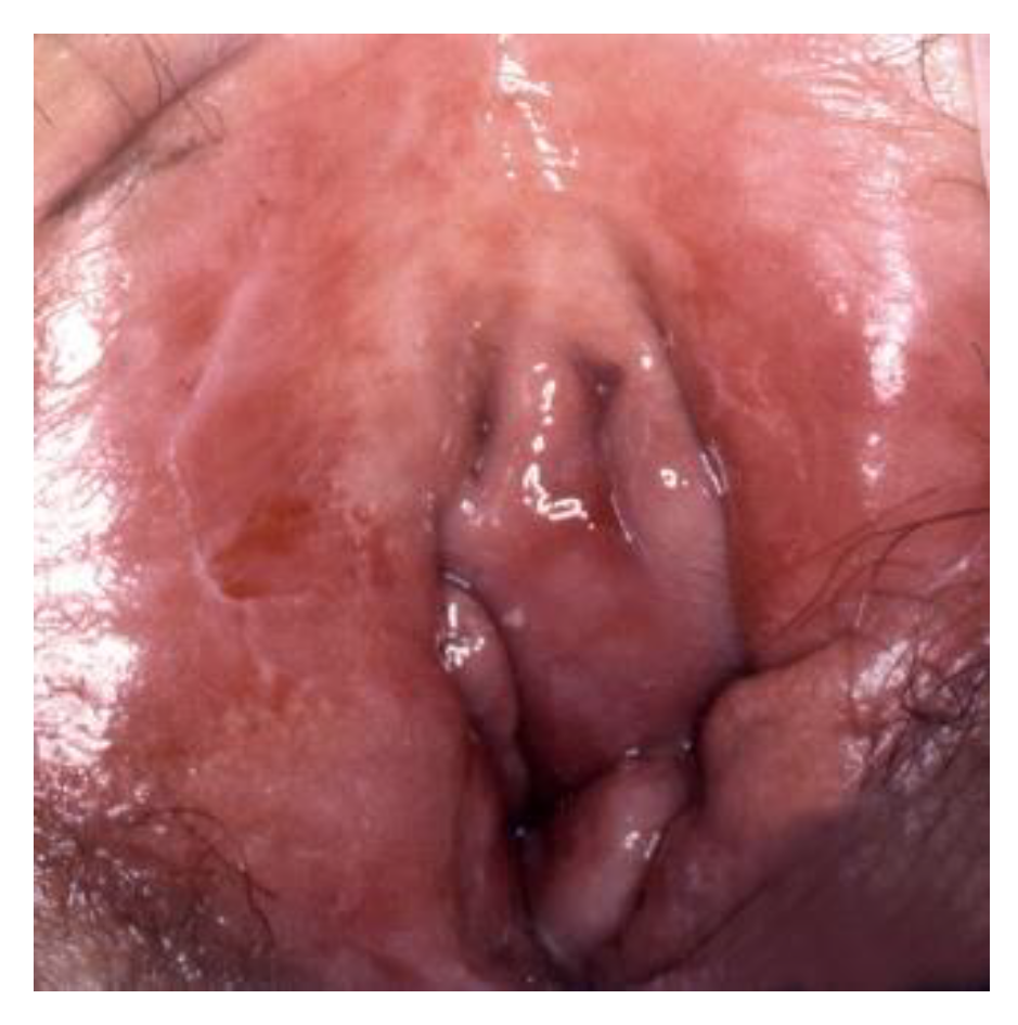 Cancers 14 01822 g005