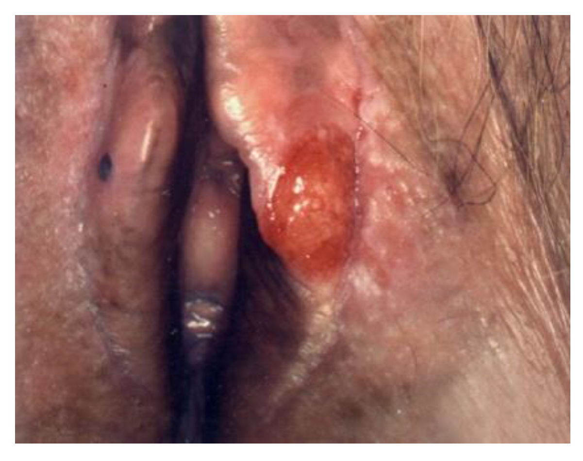 Cancers 14 01822 g007