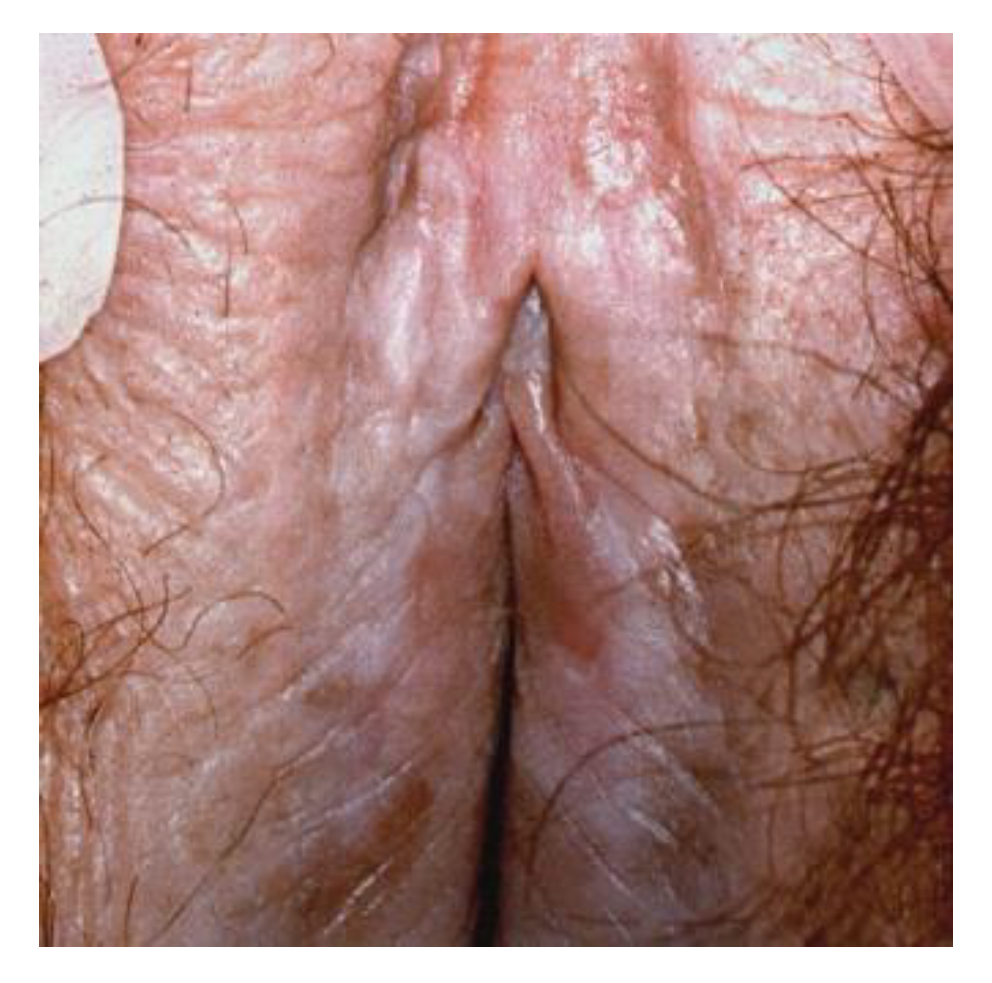 Cancers 14 01822 g008