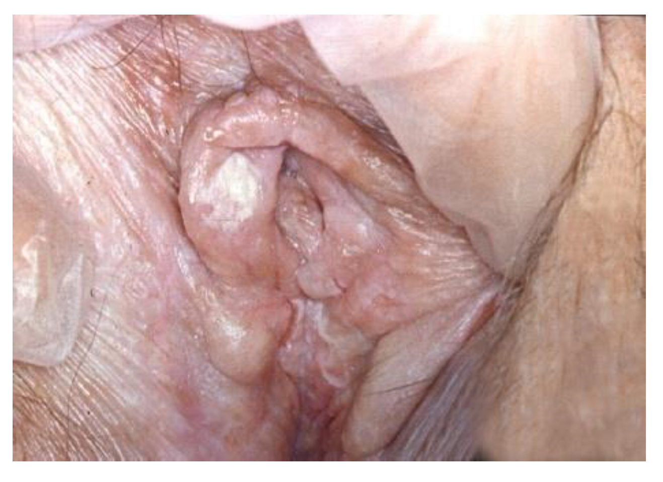 Cancers 14 01822 g010