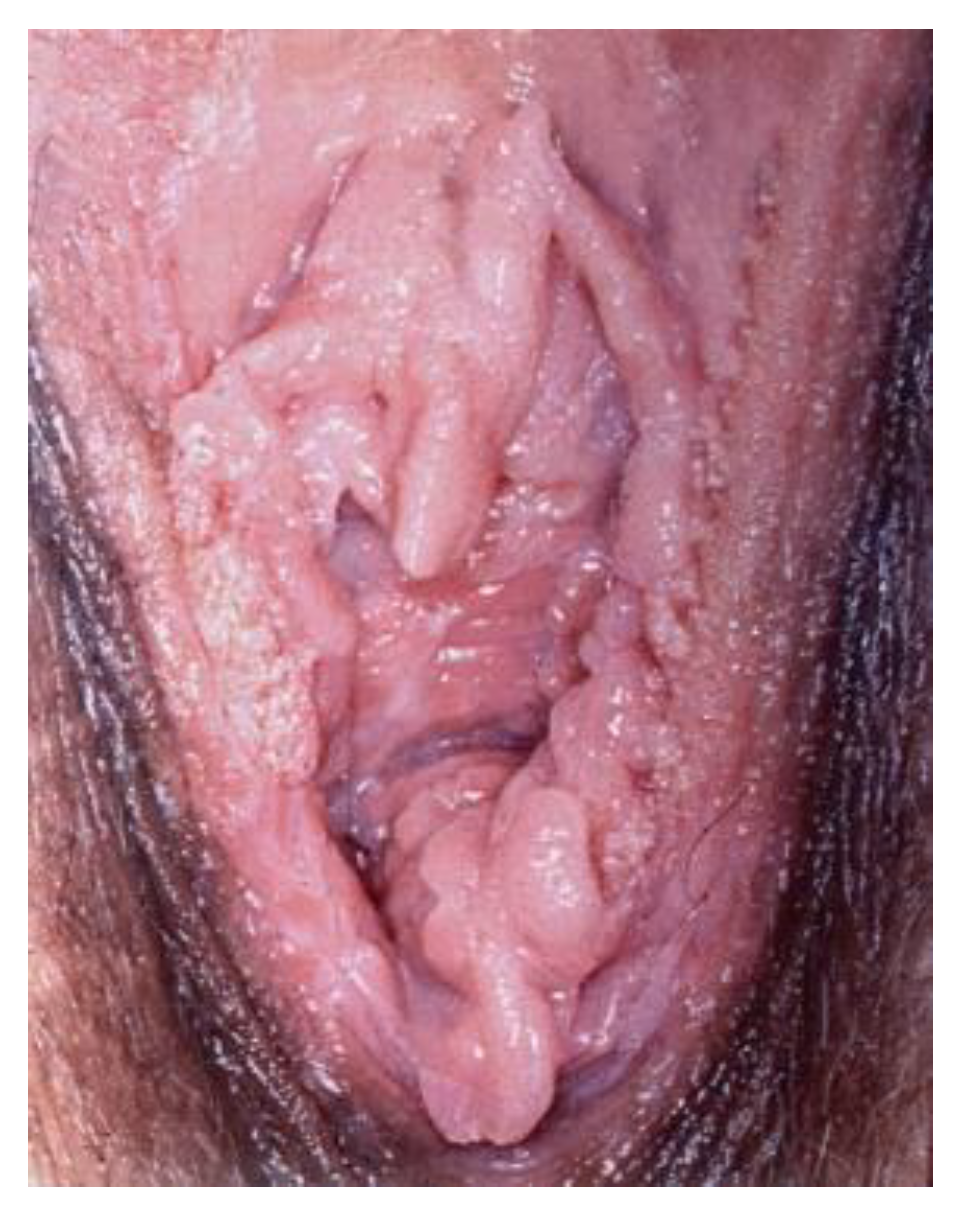 Cancers 14 01822 g015