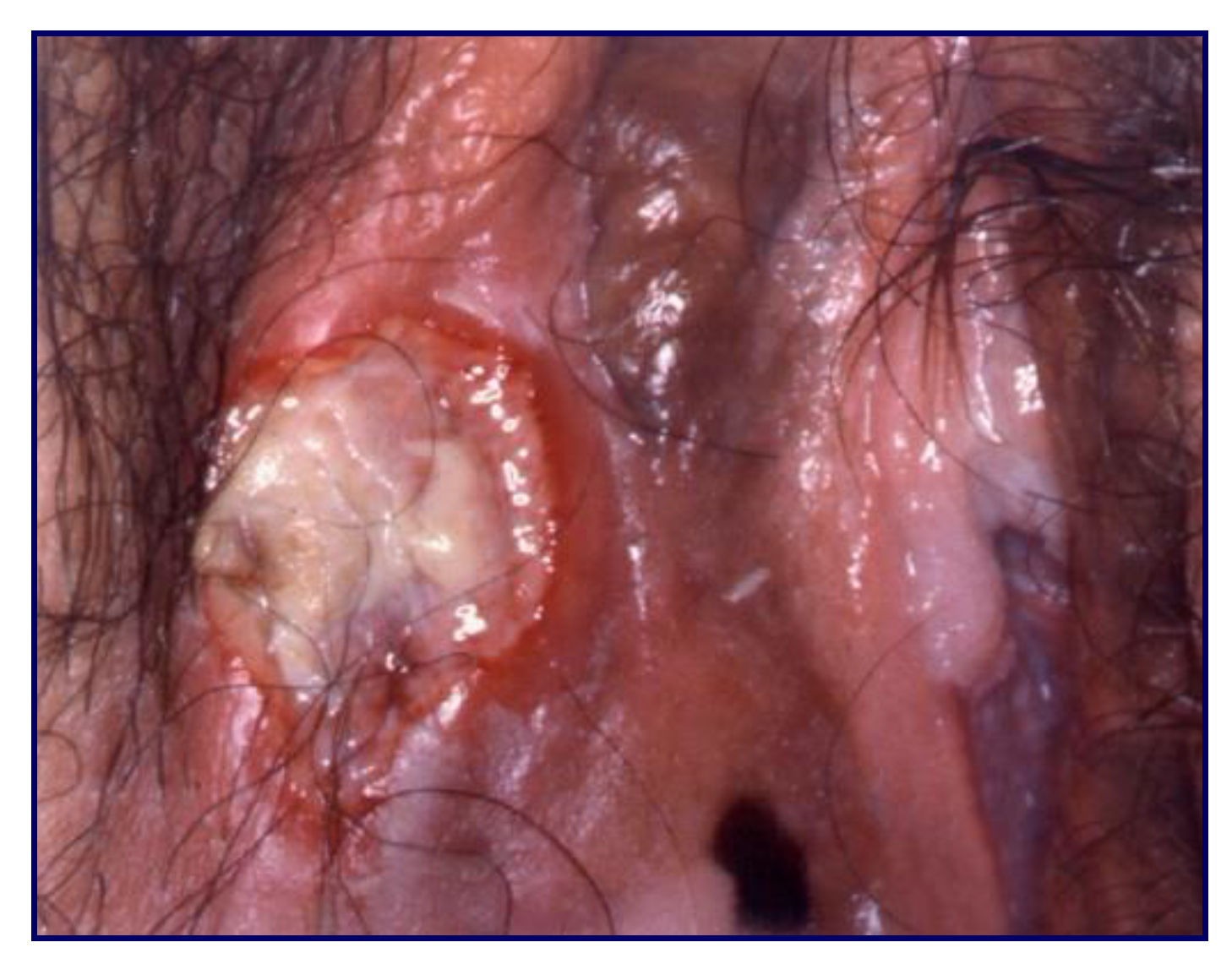 Cancers 14 01822 g020