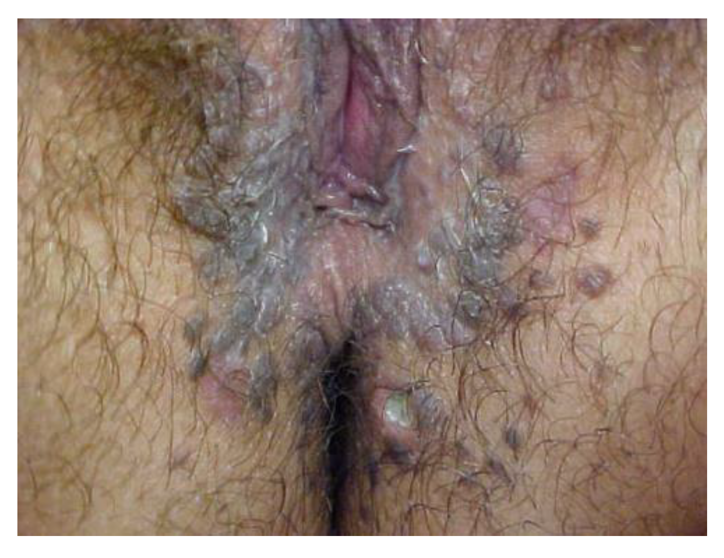 Cancers 14 01822 g022