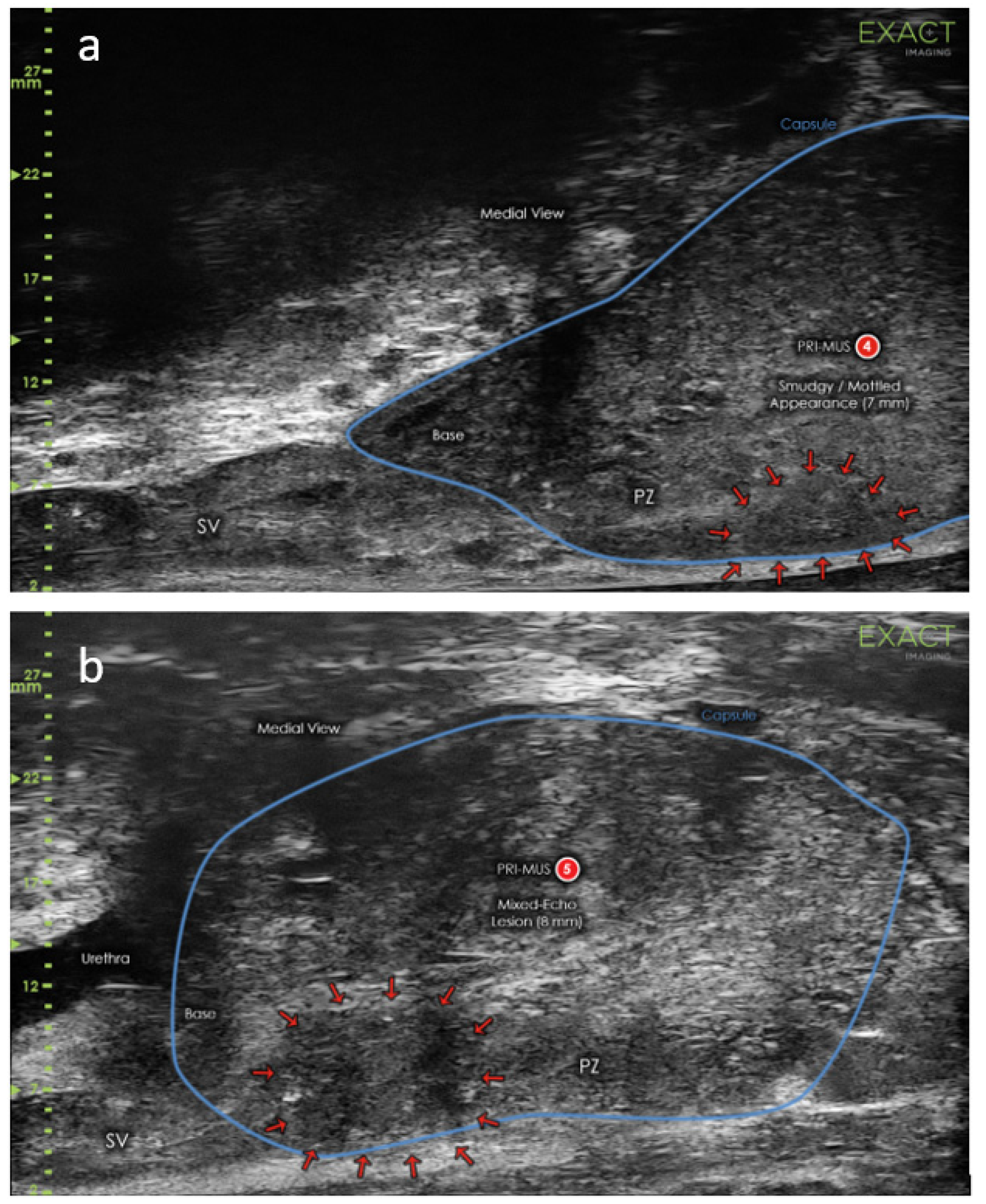 Cancers 14 01859 g003