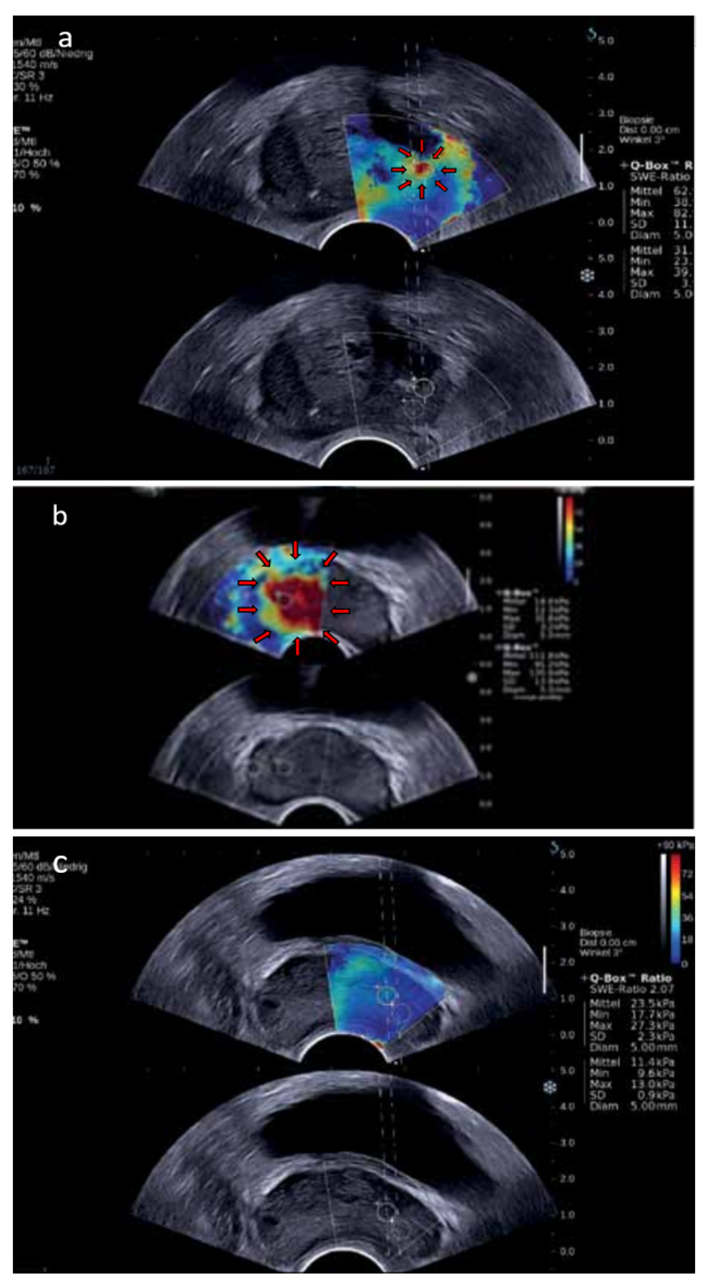 Cancers 14 01859 g004
