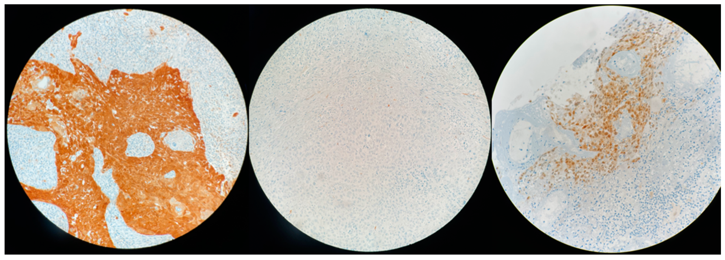 Cancers 14 01874 g004