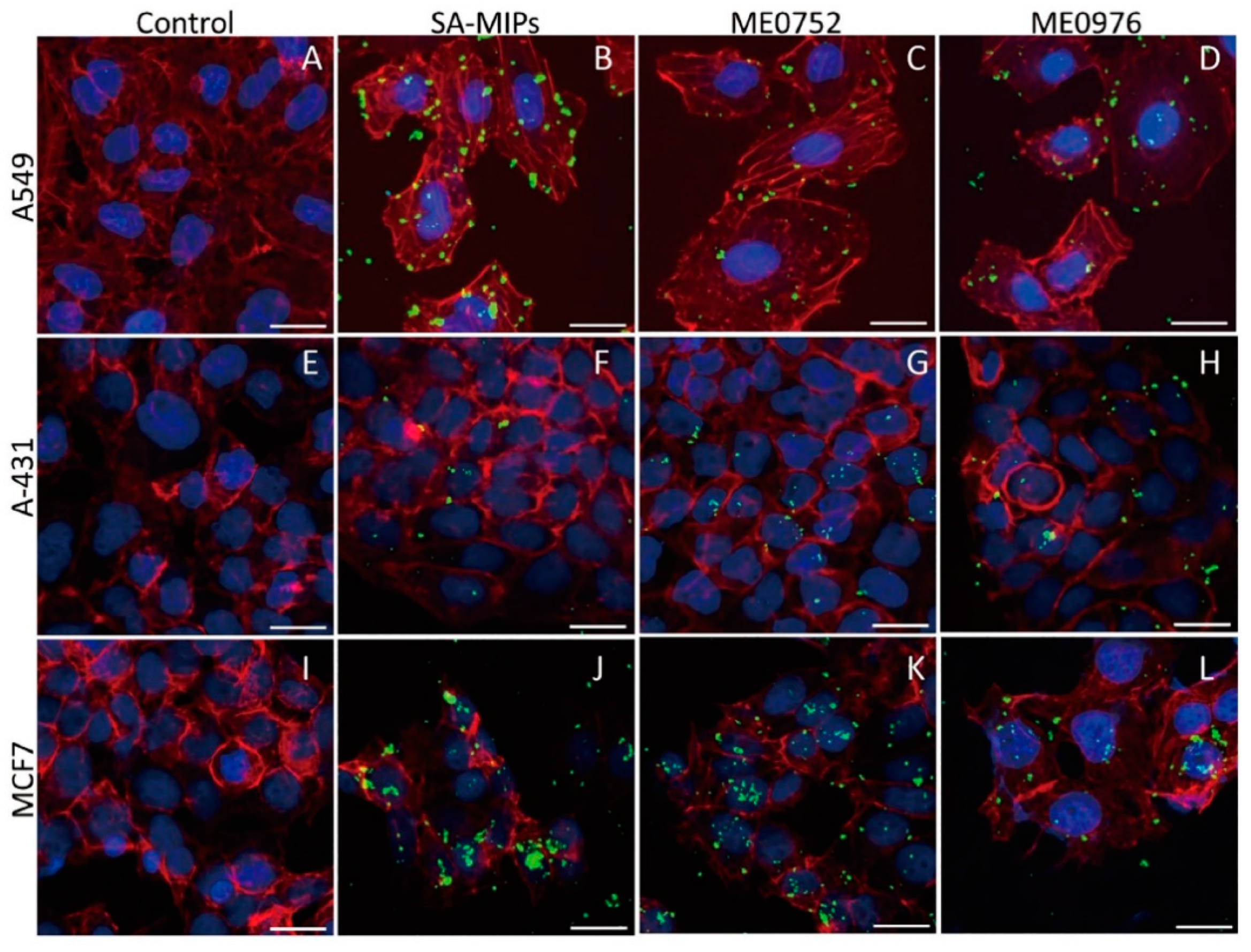 Cancers 14 01875 g004