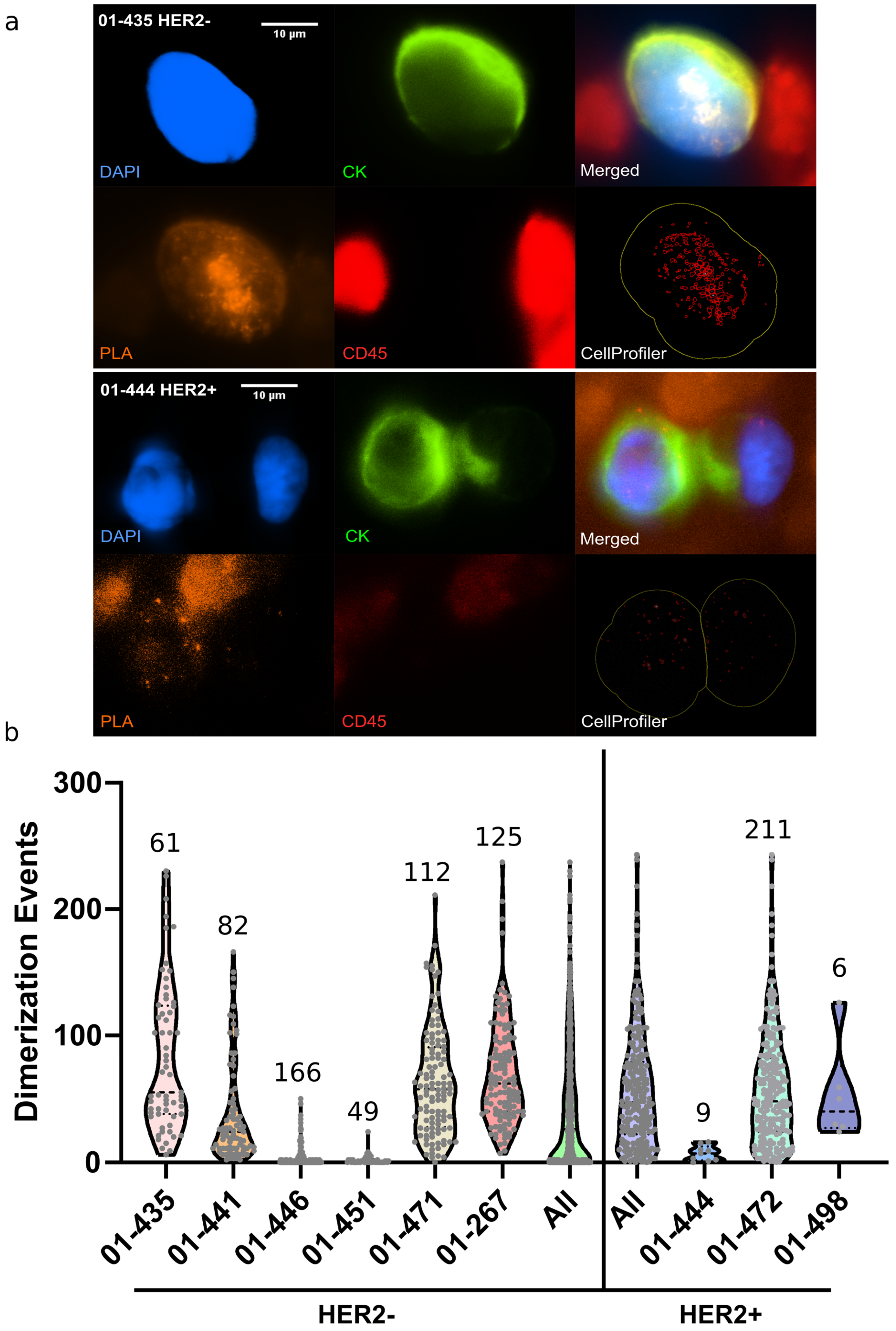 Cancers 14 01890 g004