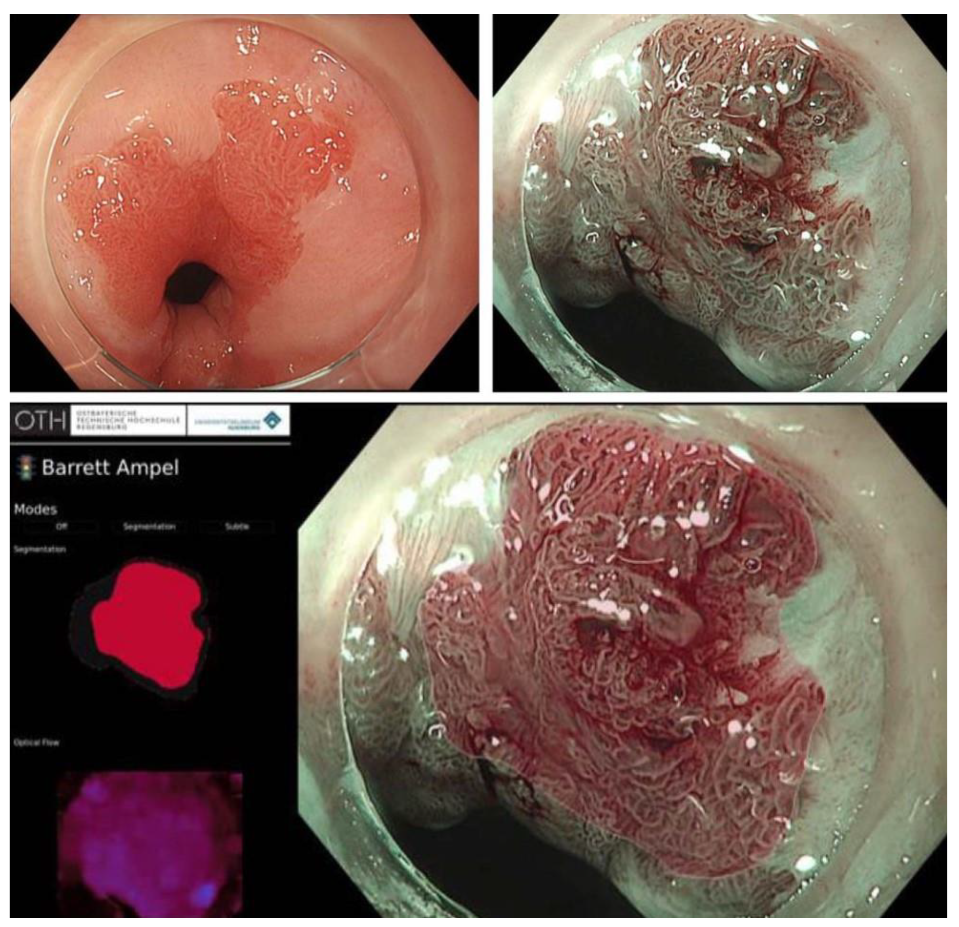 Cancers 14 01918 g002