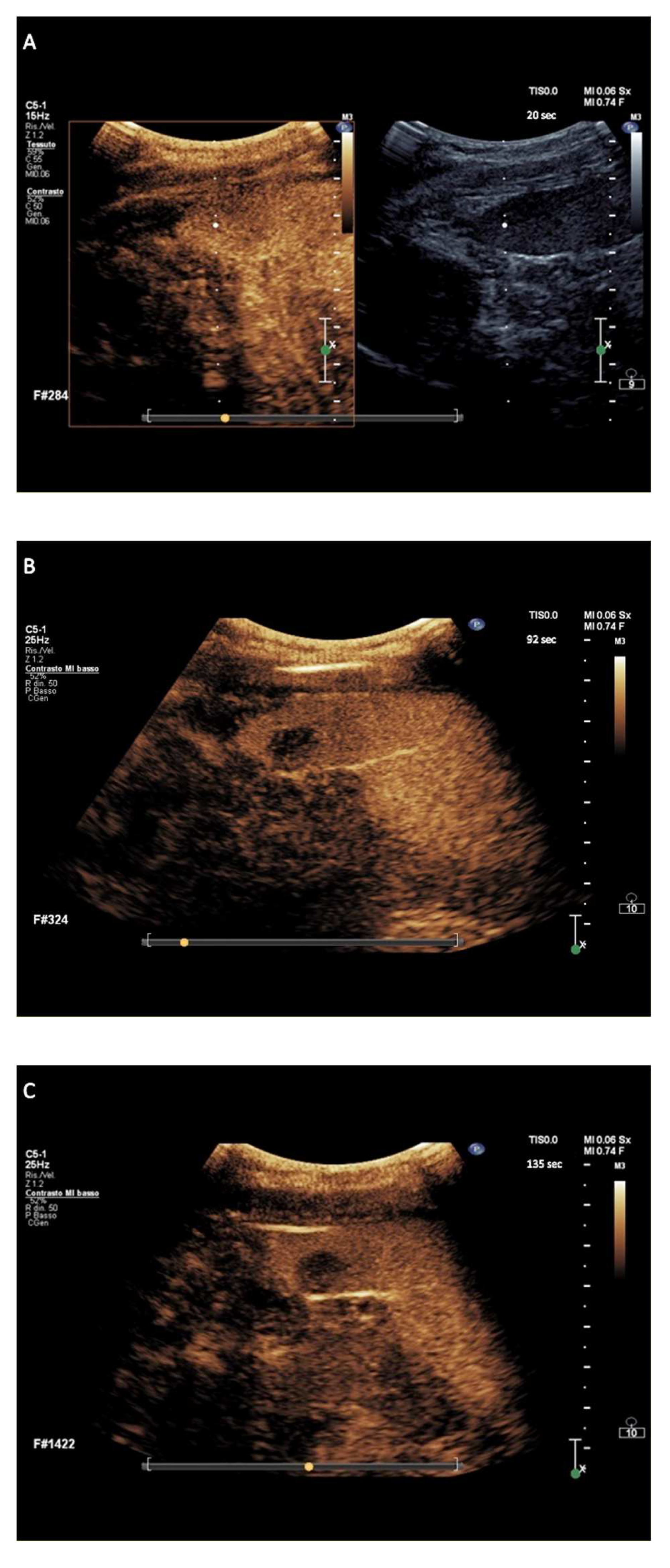 Cancers 14 01927 g003