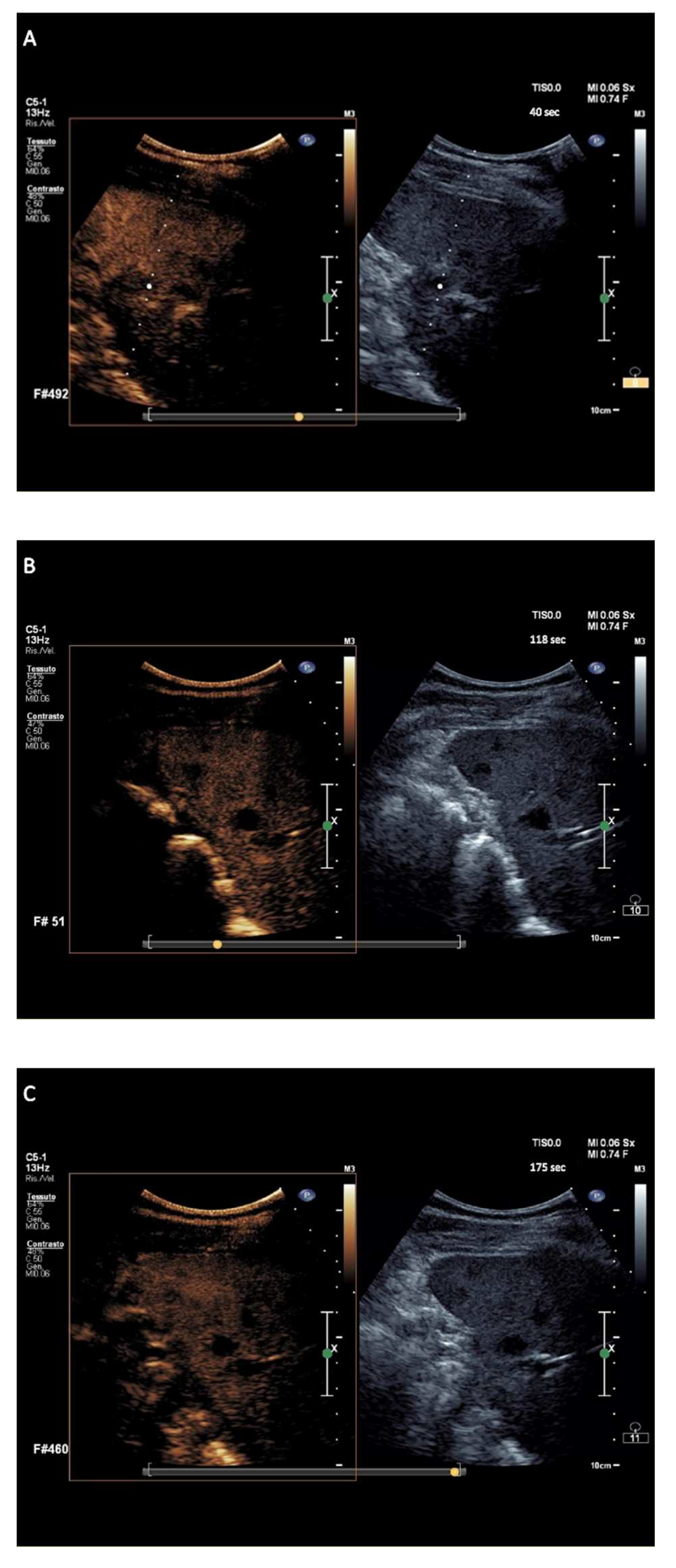 Cancers 14 01927 g004