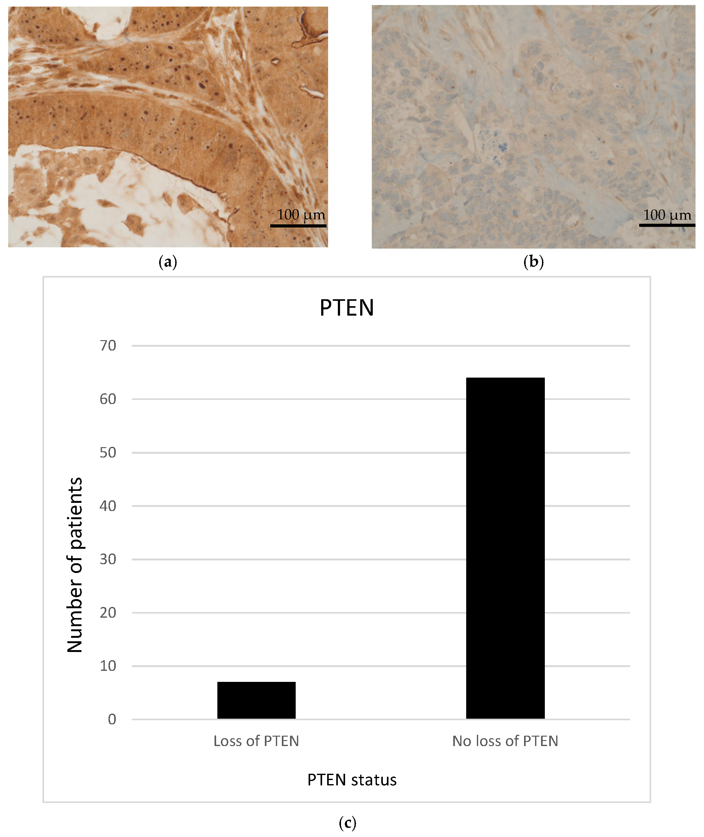 Cancers 14 01936 g003
