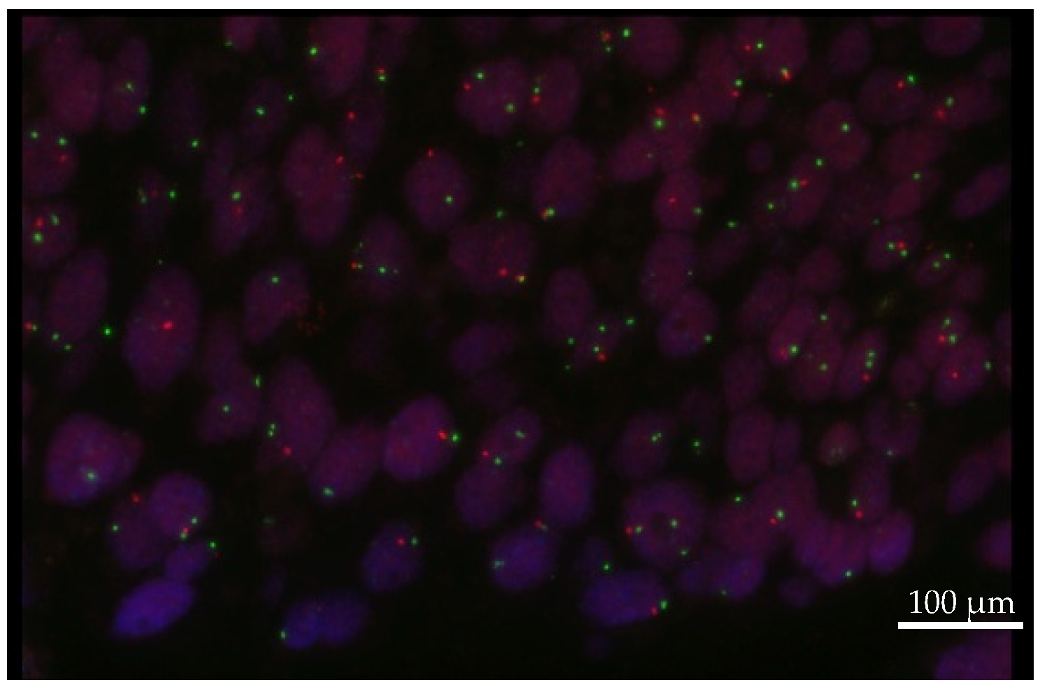 Cancers 14 01936 g004