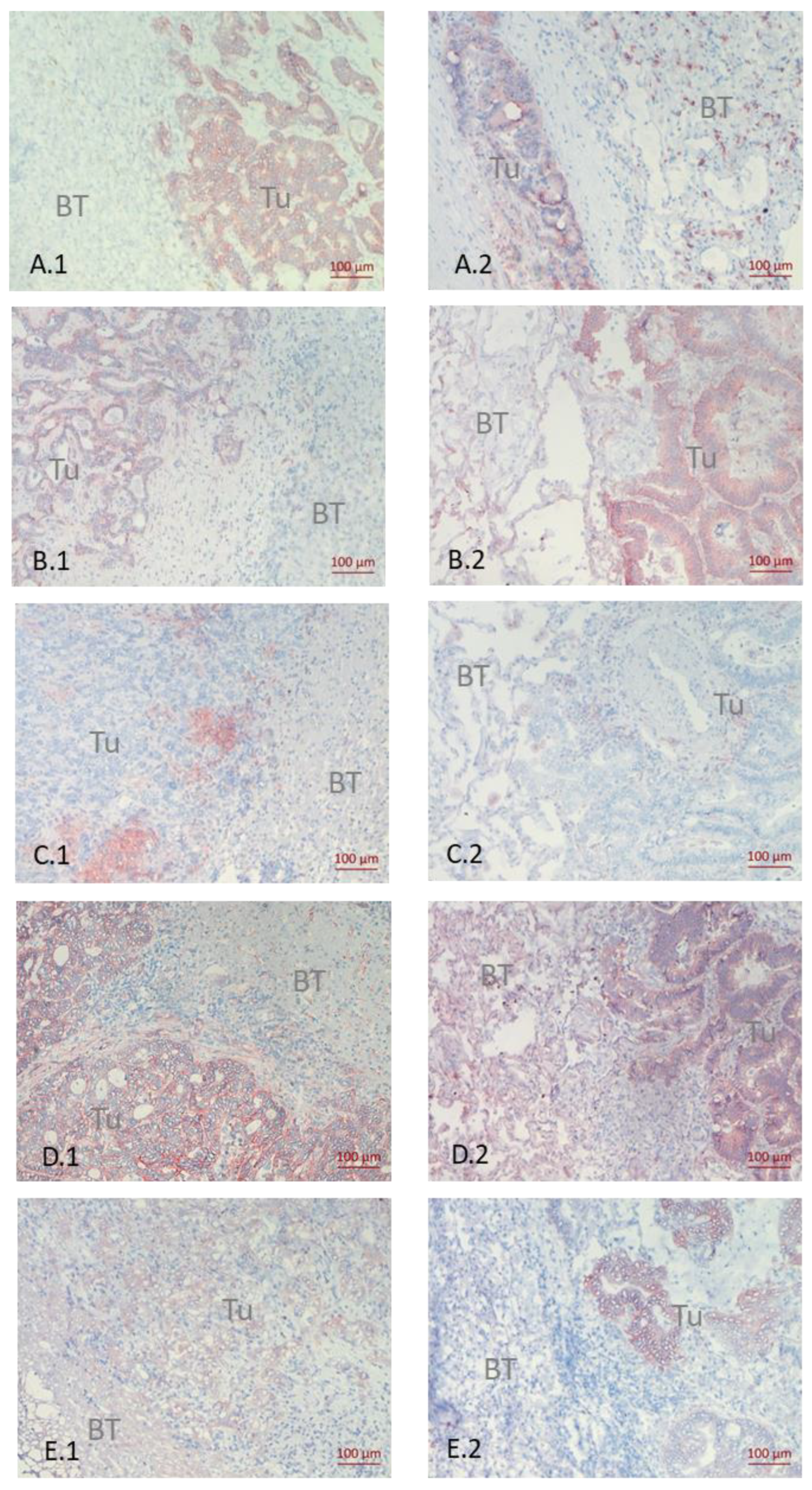 Cancers 14 01939 g002