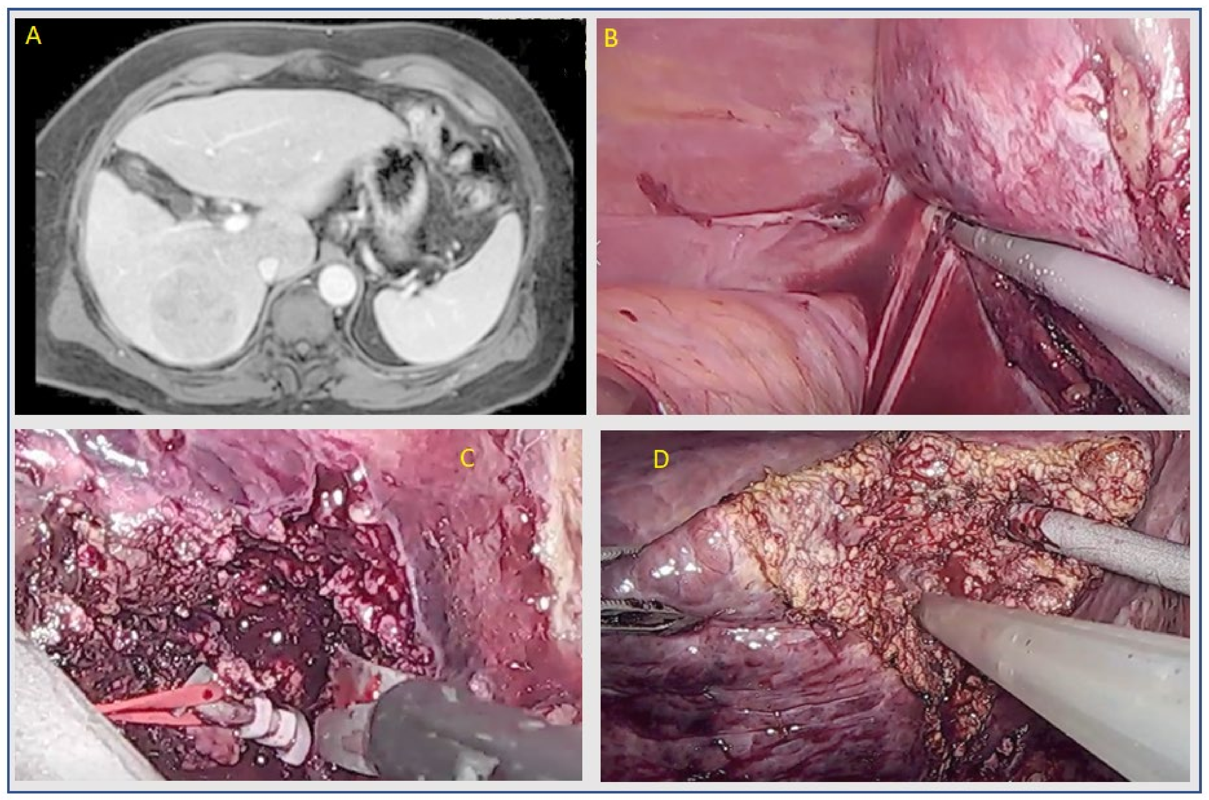 Cancers 14 02012 g002