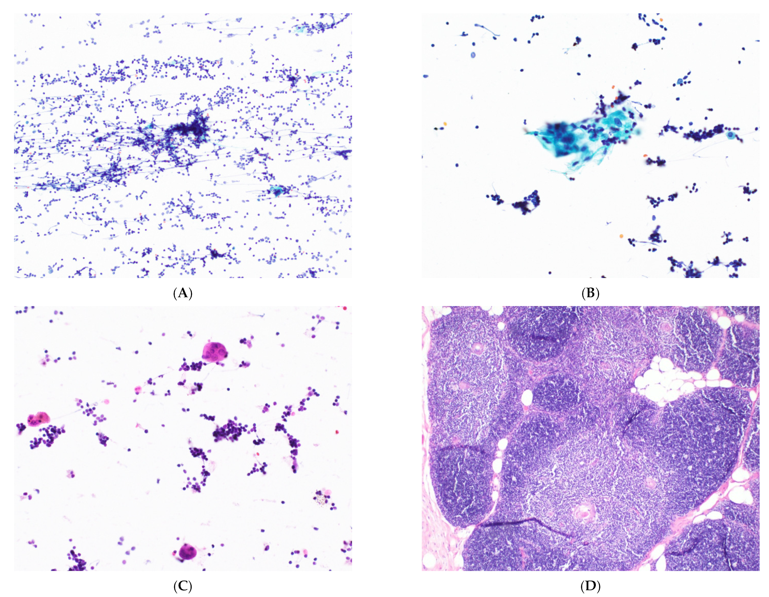 Cancers 14 02013 g002