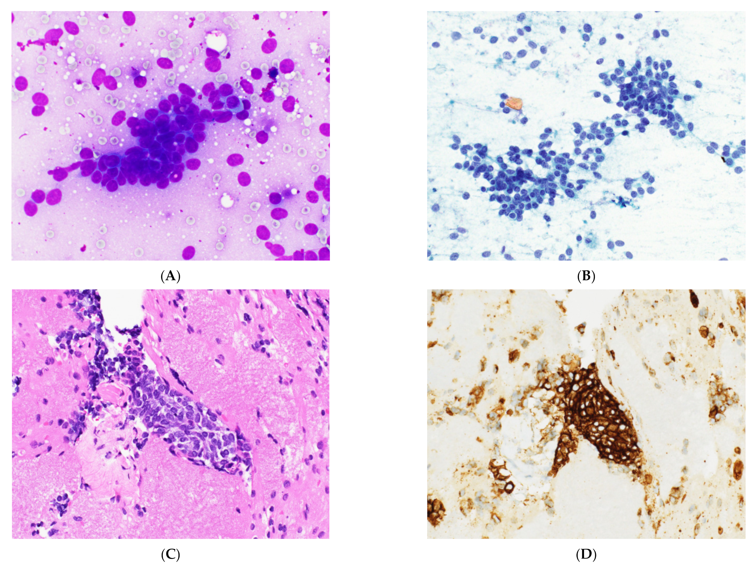 Cancers 14 02013 g007