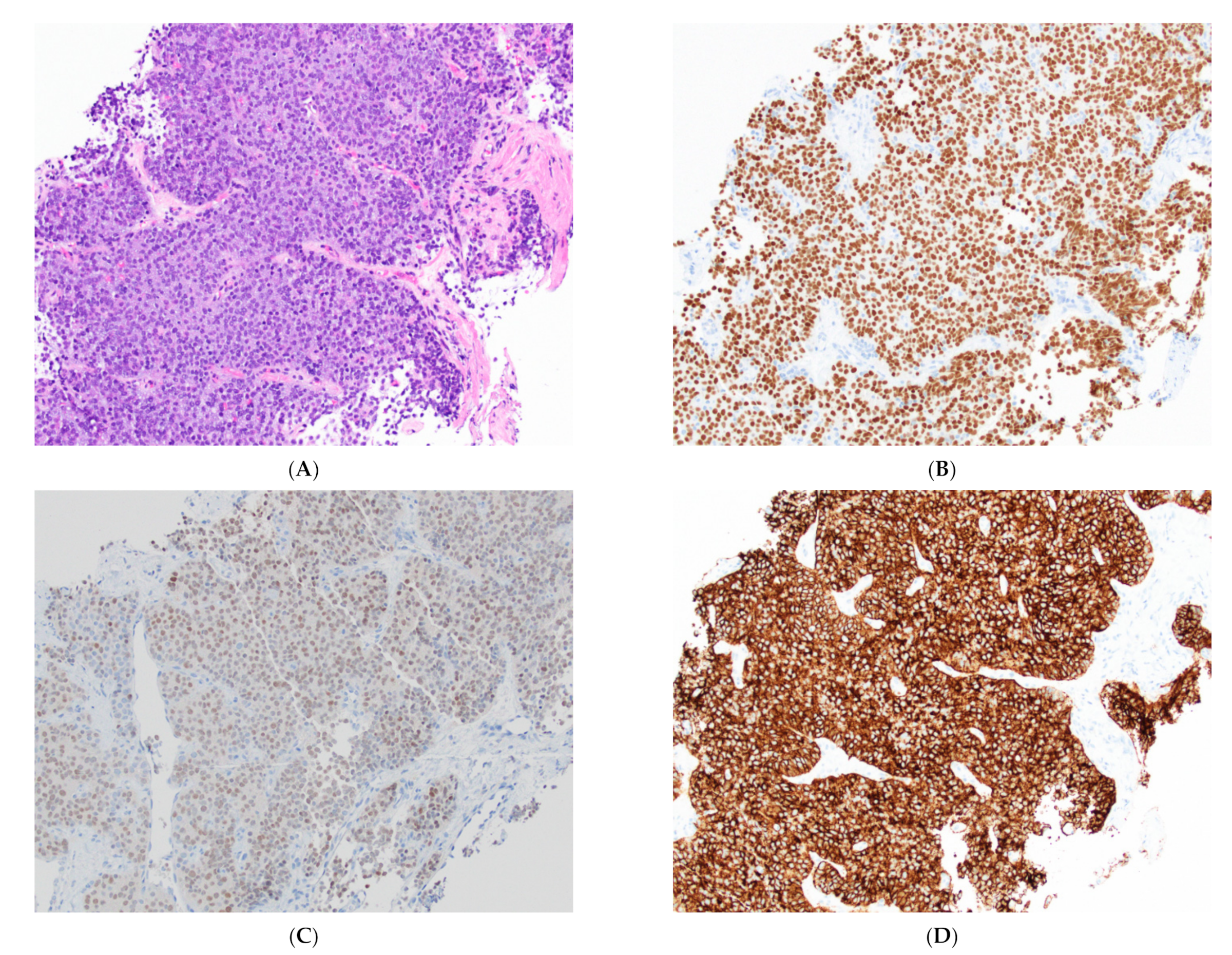 Cancers 14 02013 g008