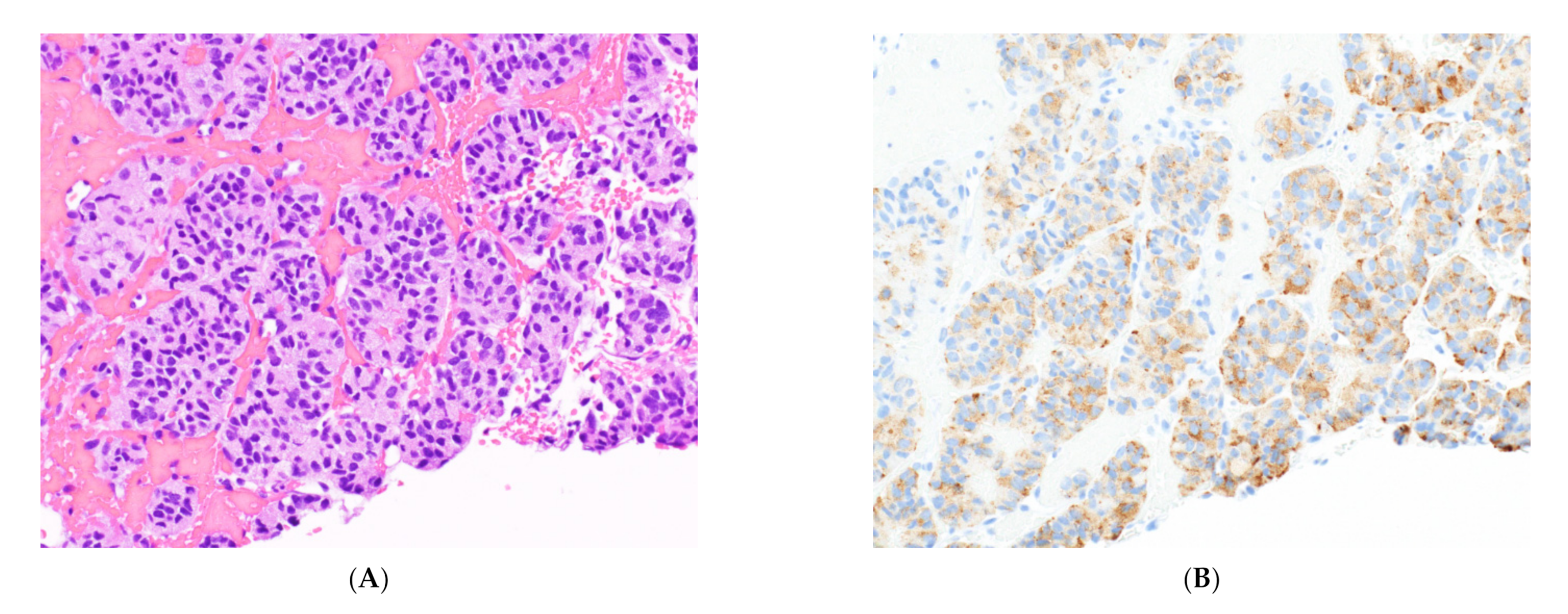 Cancers 14 02013 g009a