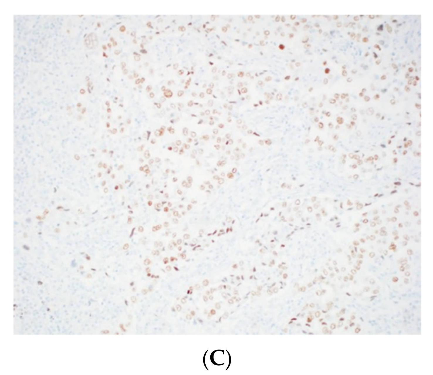 Cancers 14 02013 g010b