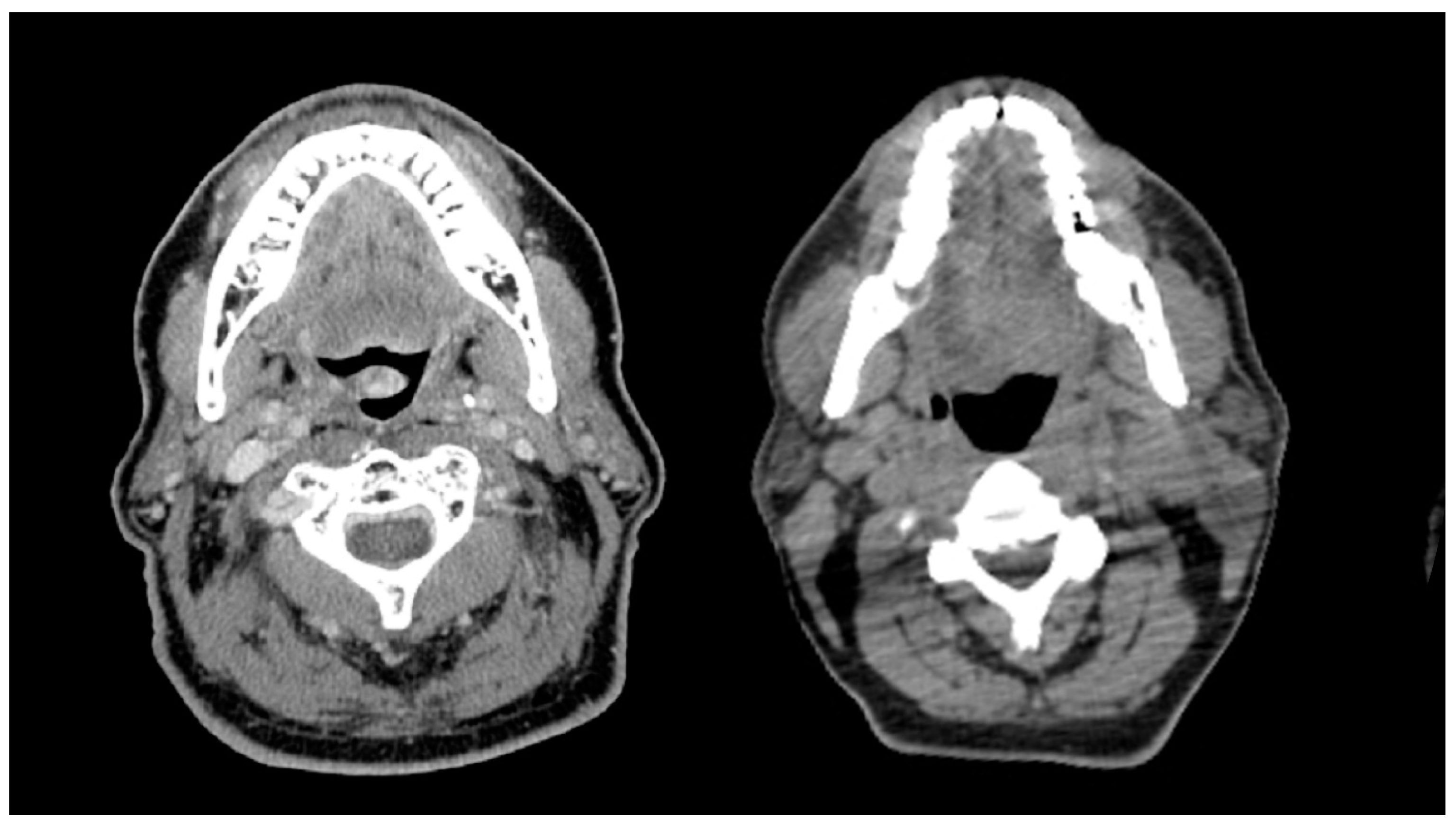 Cancers 14 02094 g002