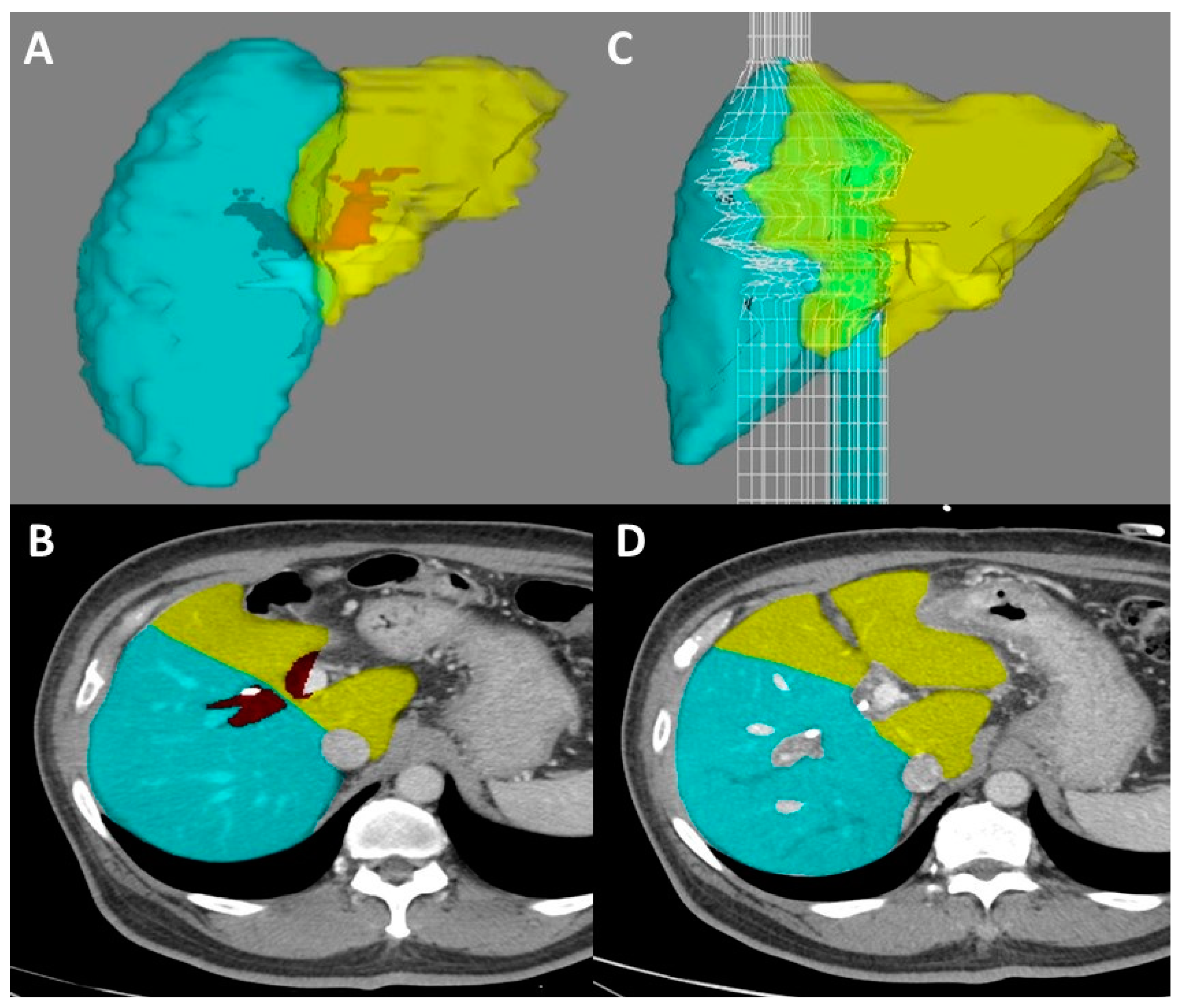 Cancers 14 02119 g004