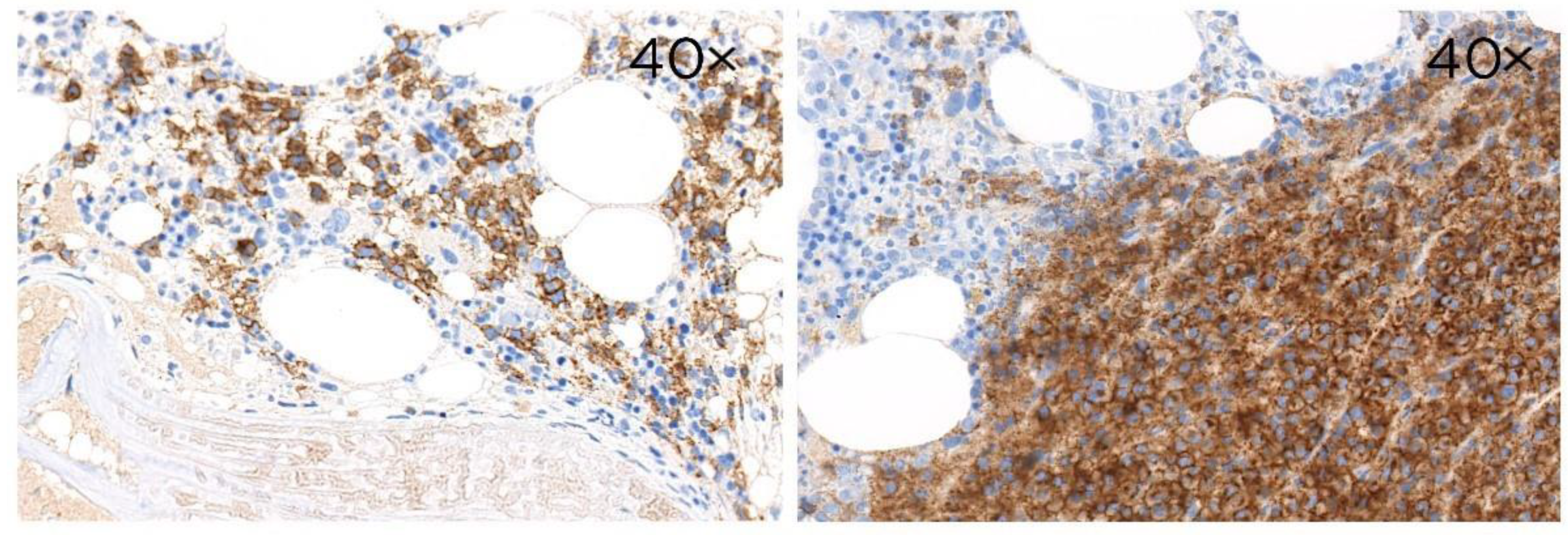 Cancers 14 02154 g005