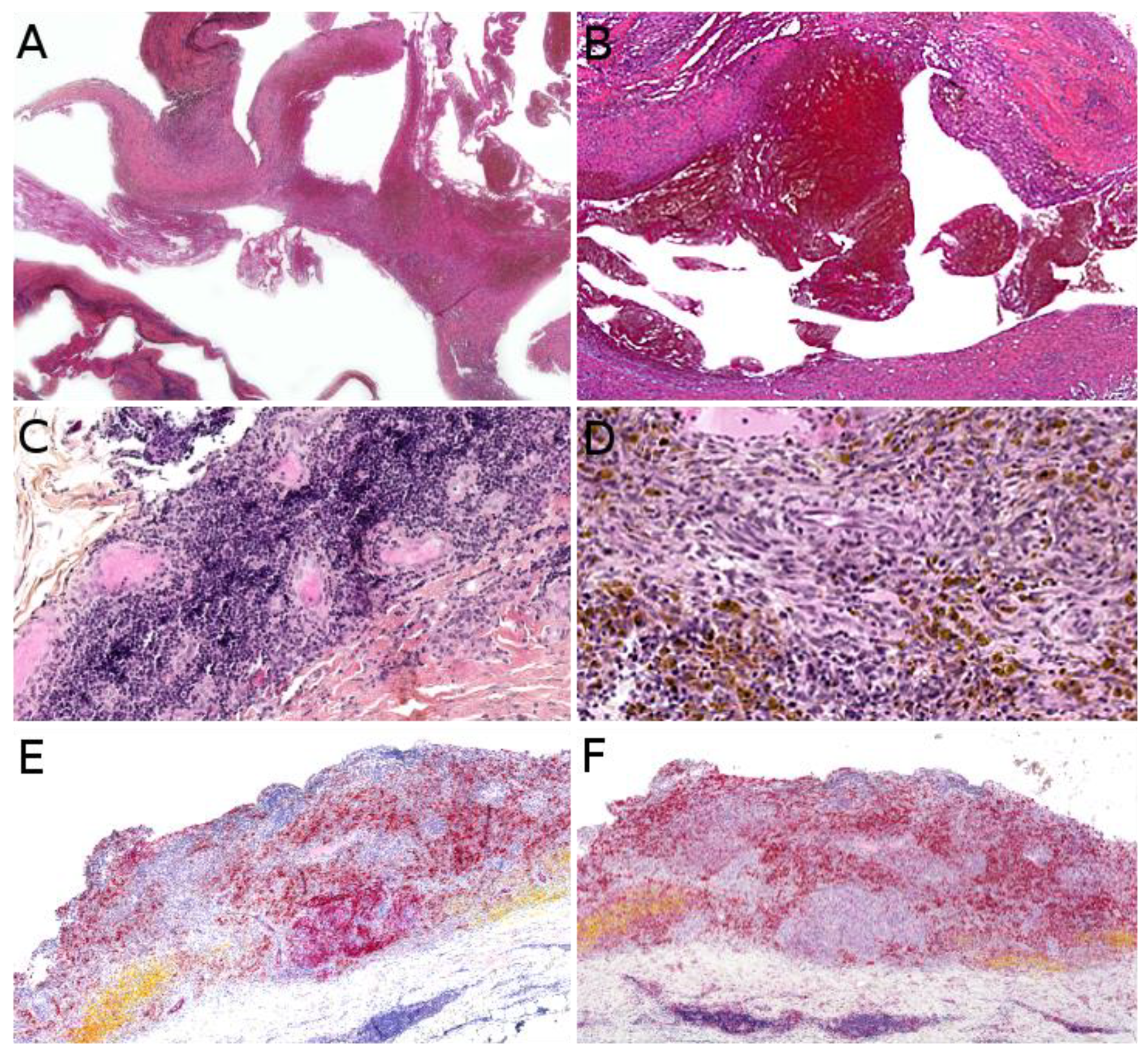 Cancers 14 02160 g002 Cancers 14 02160 g002