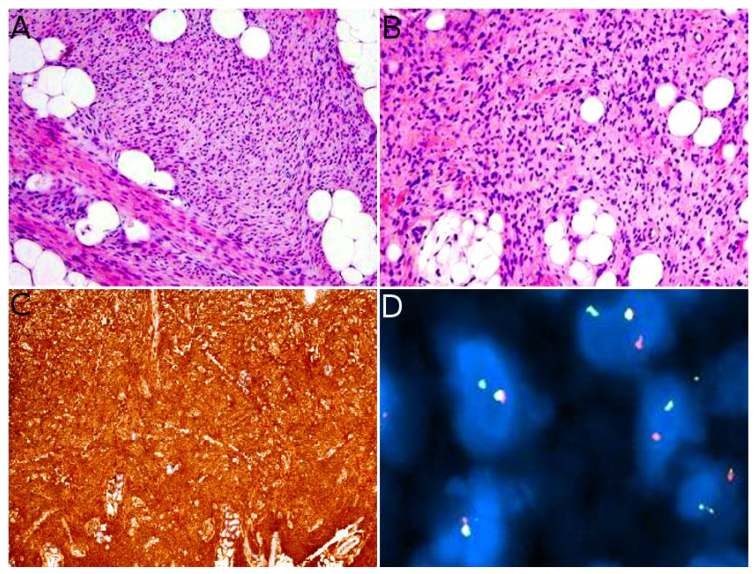 Cancers 14 02160 g004 Cancers 14 02160 g004