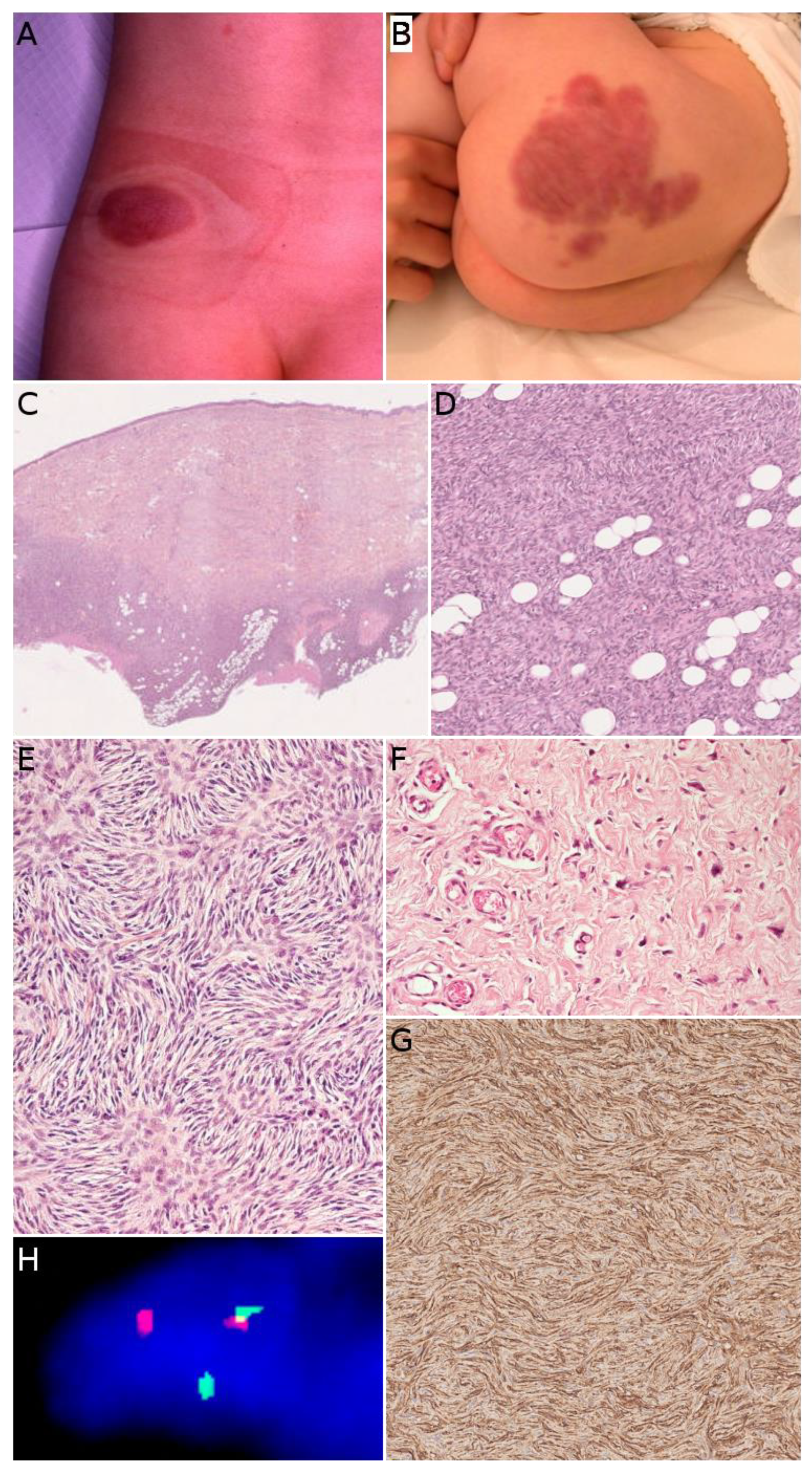 Cancers 14 02160 g005 Cancers 14 02160 g005