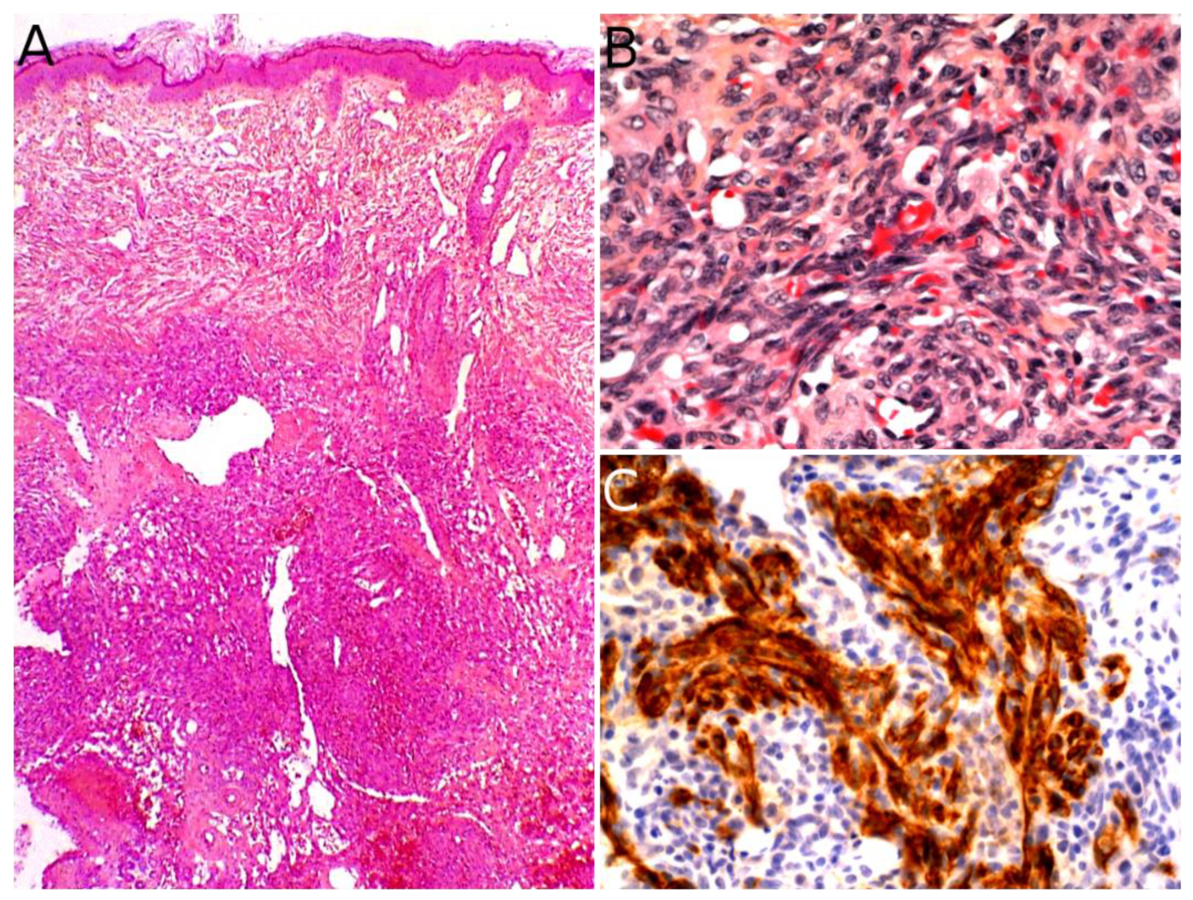 Cancers 14 02160 g007 Cancers 14 02160 g007