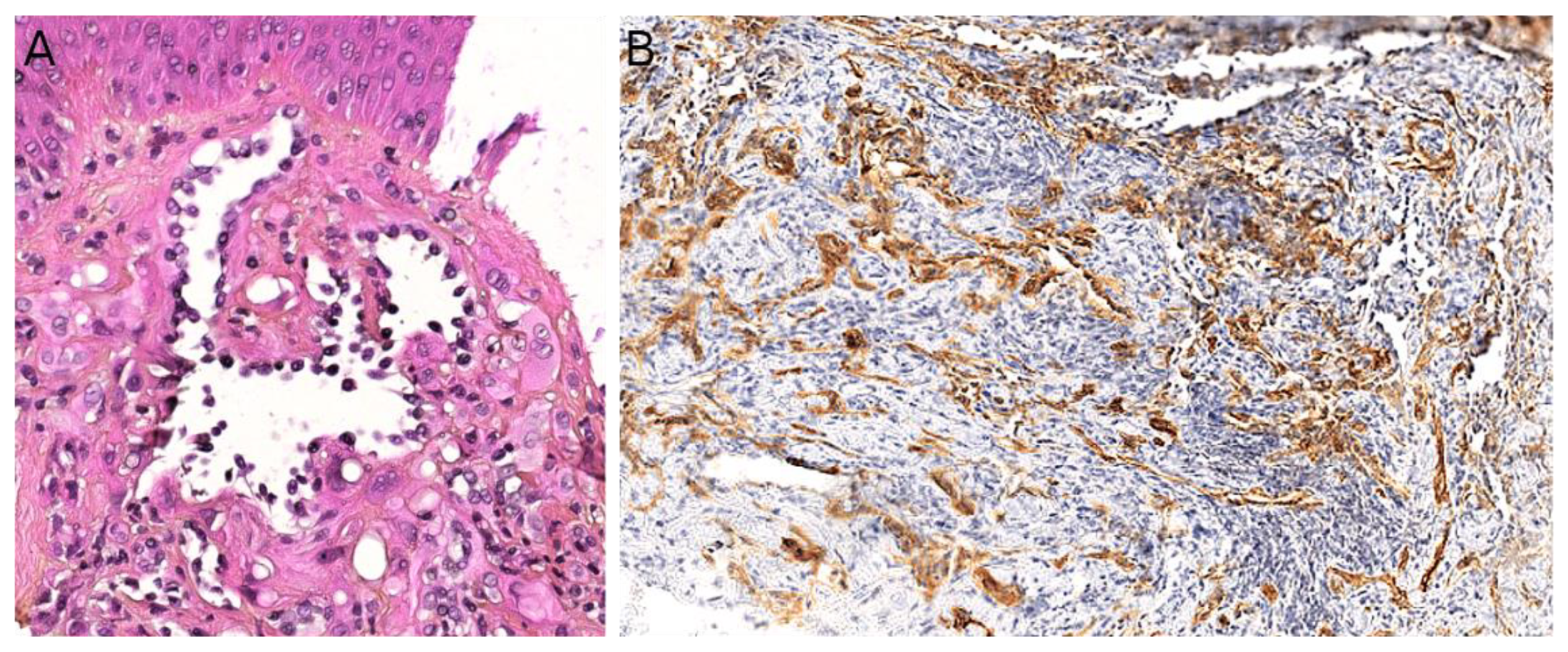 Cancers 14 02160 g008 Cancers 14 02160 g008