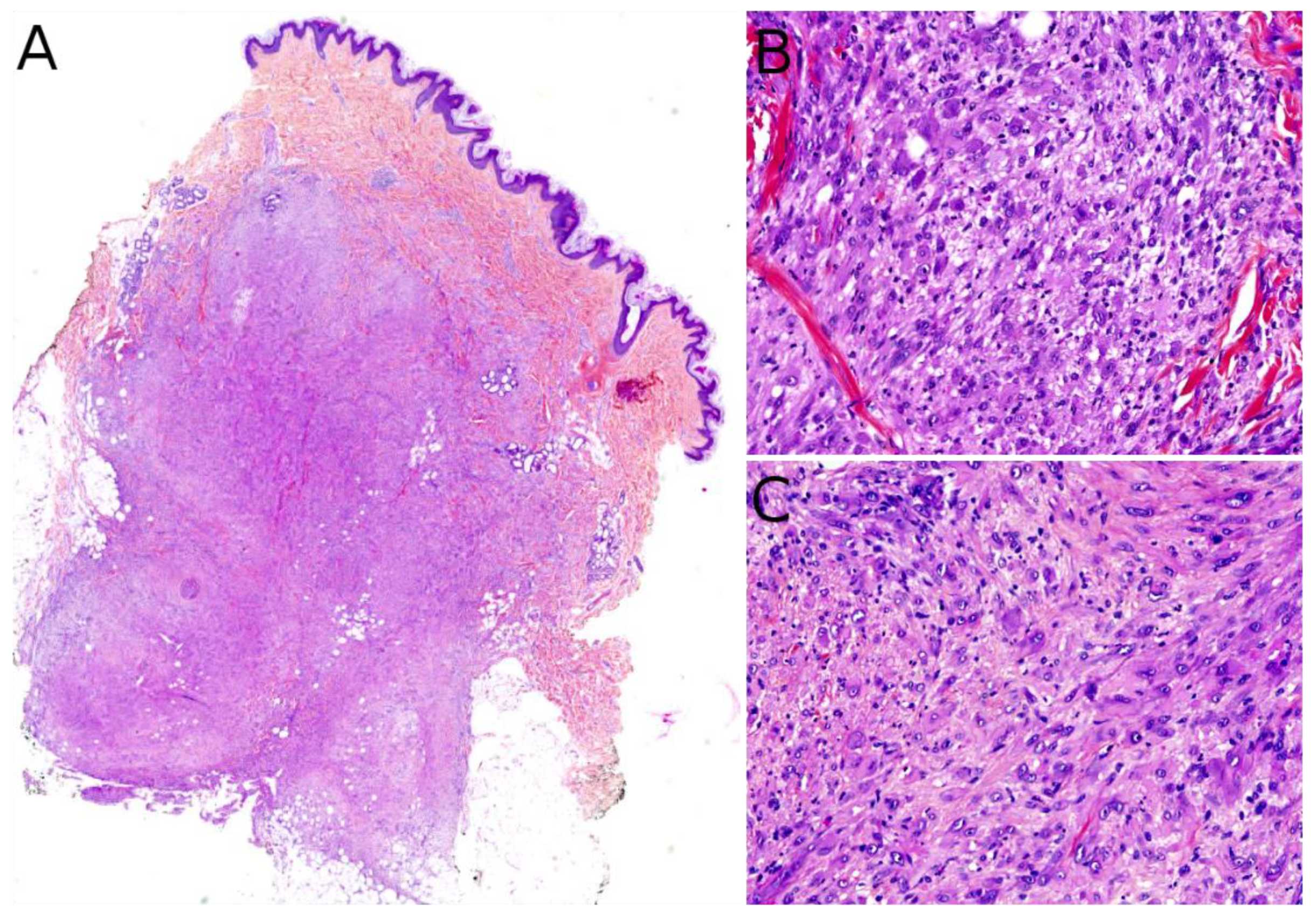 Cancers 14 02160 g009 Cancers 14 02160 g009