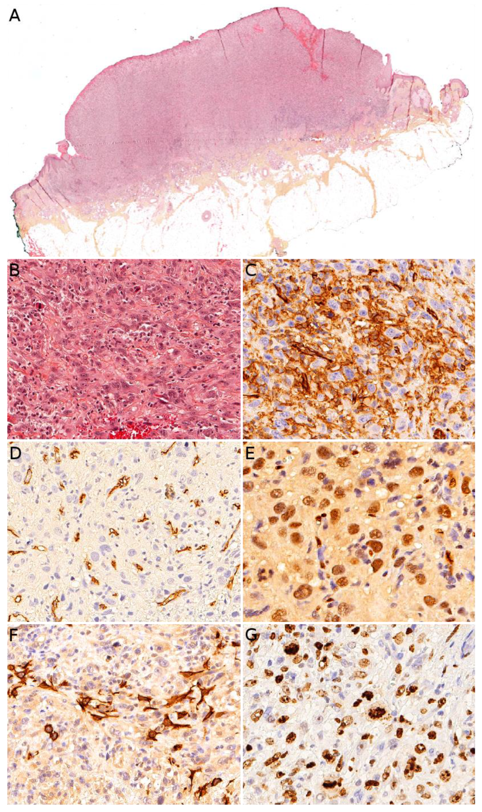 Cancers 14 02160 g010 Cancers 14 02160 g010