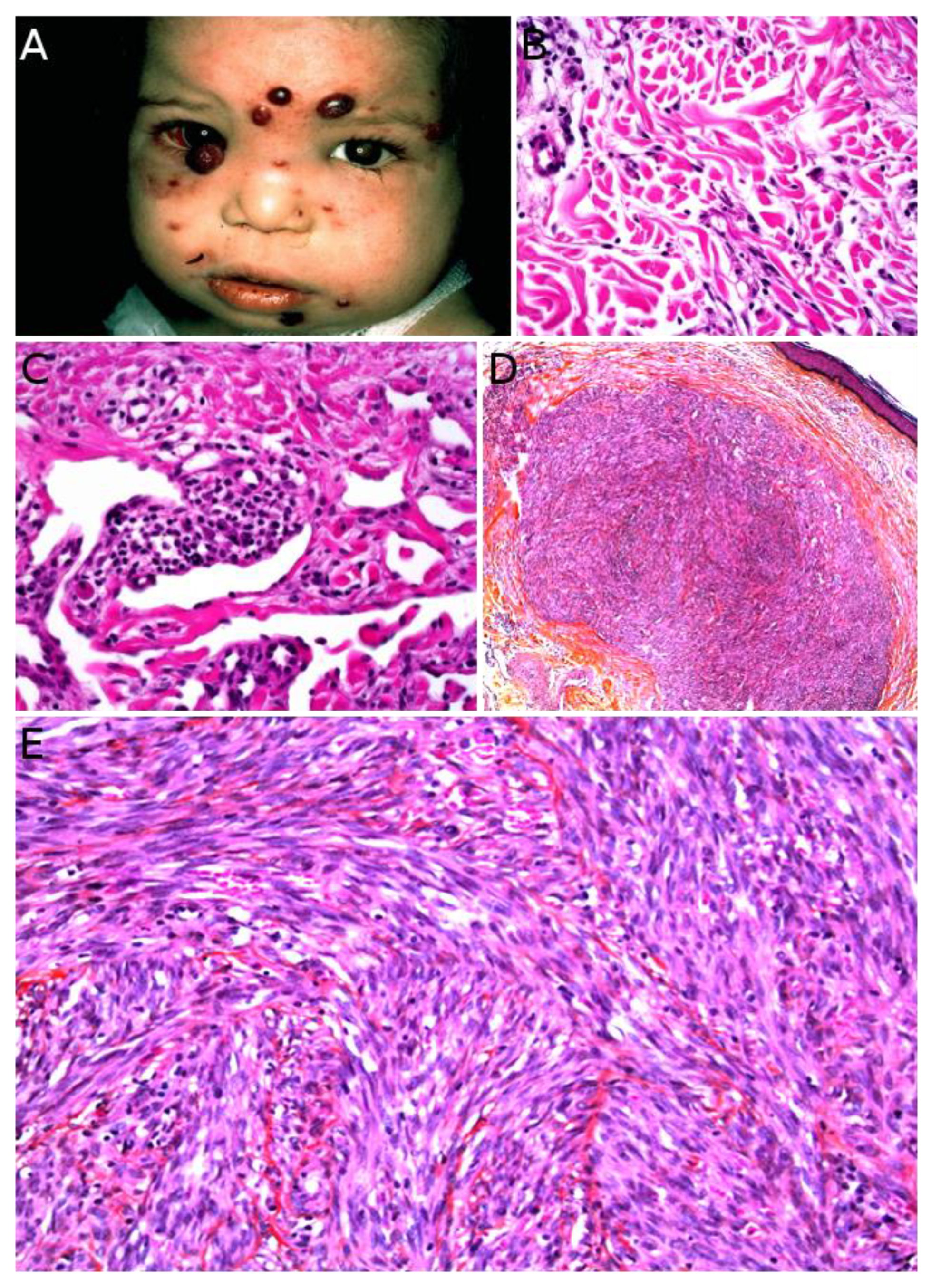 Cancers 14 02160 g011 Cancers 14 02160 g011