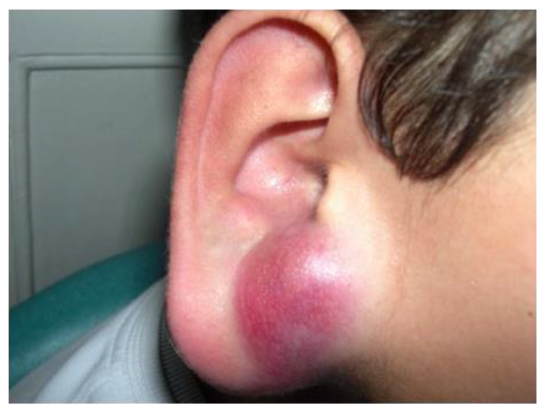 Cancers 14 02160 g012 Cancers 14 02160 g012