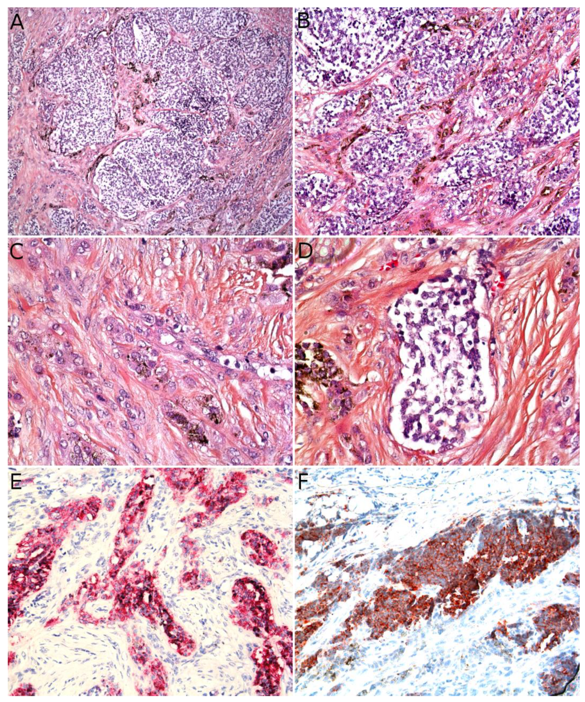 Cancers 14 02160 g013 Cancers 14 02160 g013