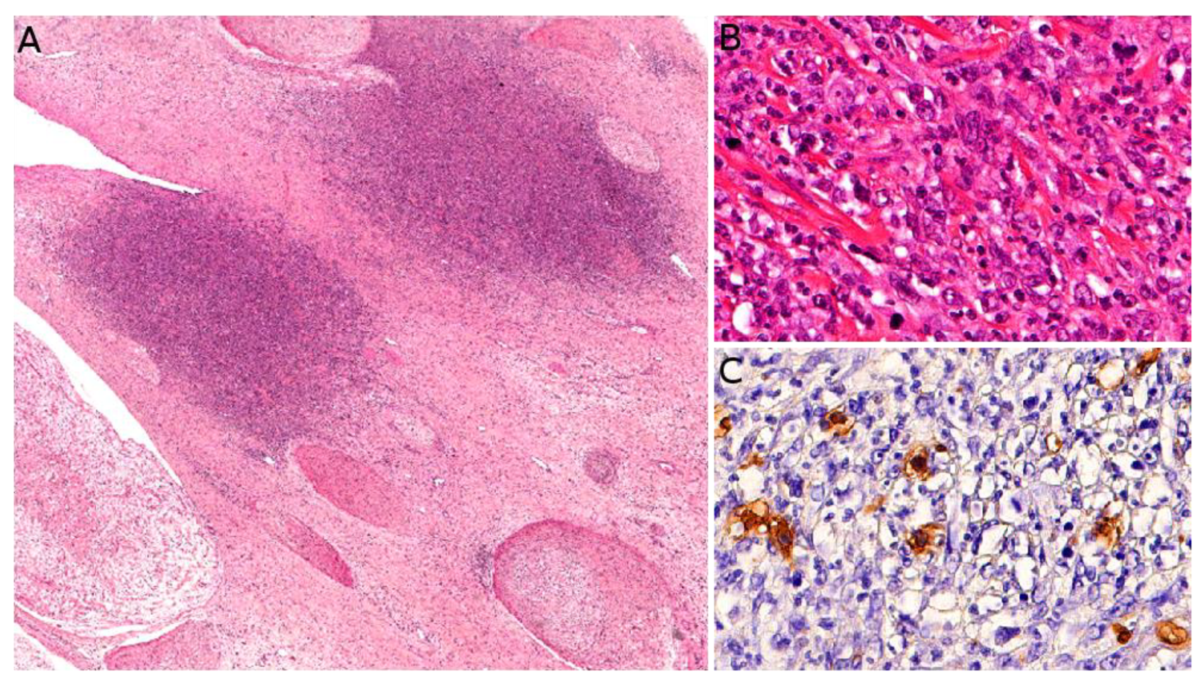 Cancers 14 02160 g014 Cancers 14 02160 g014