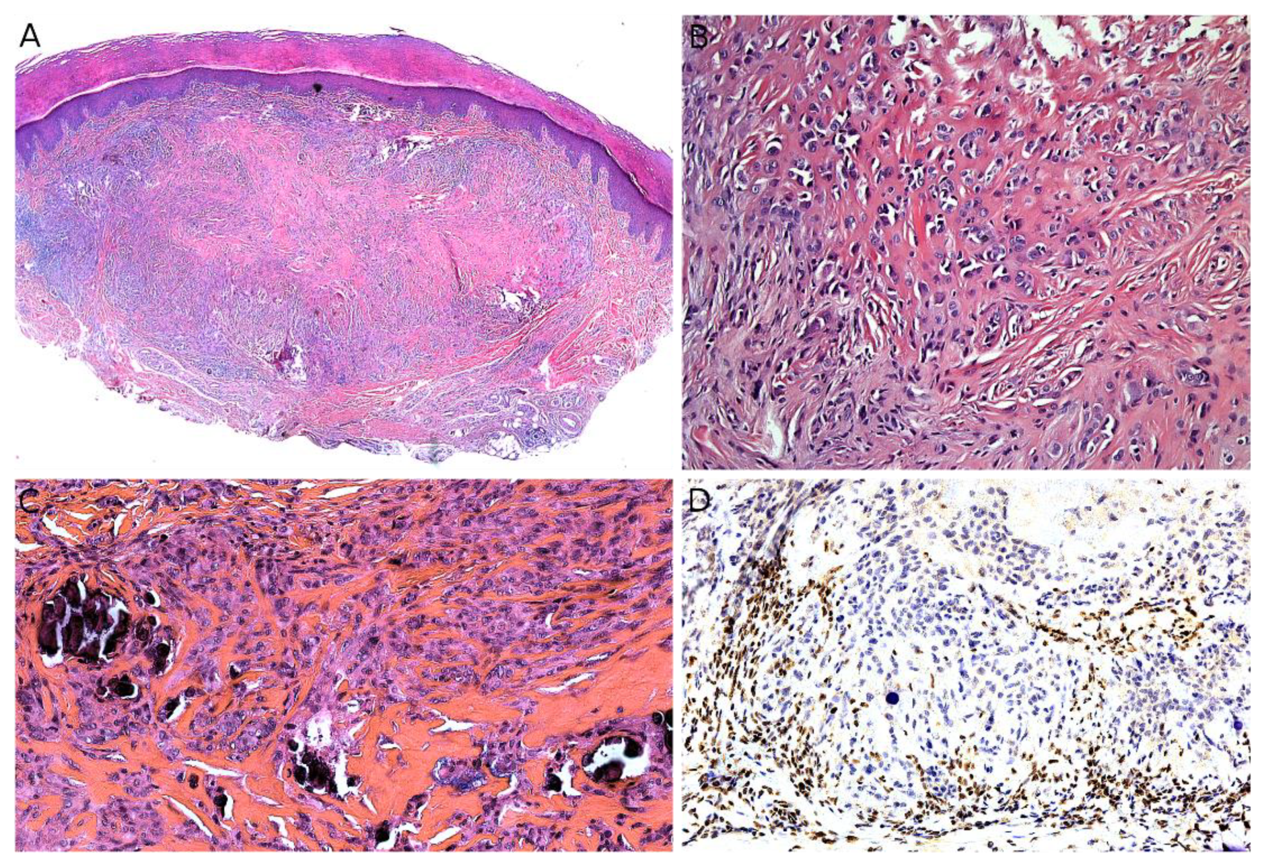 Cancers 14 02160 g015 Cancers 14 02160 g015