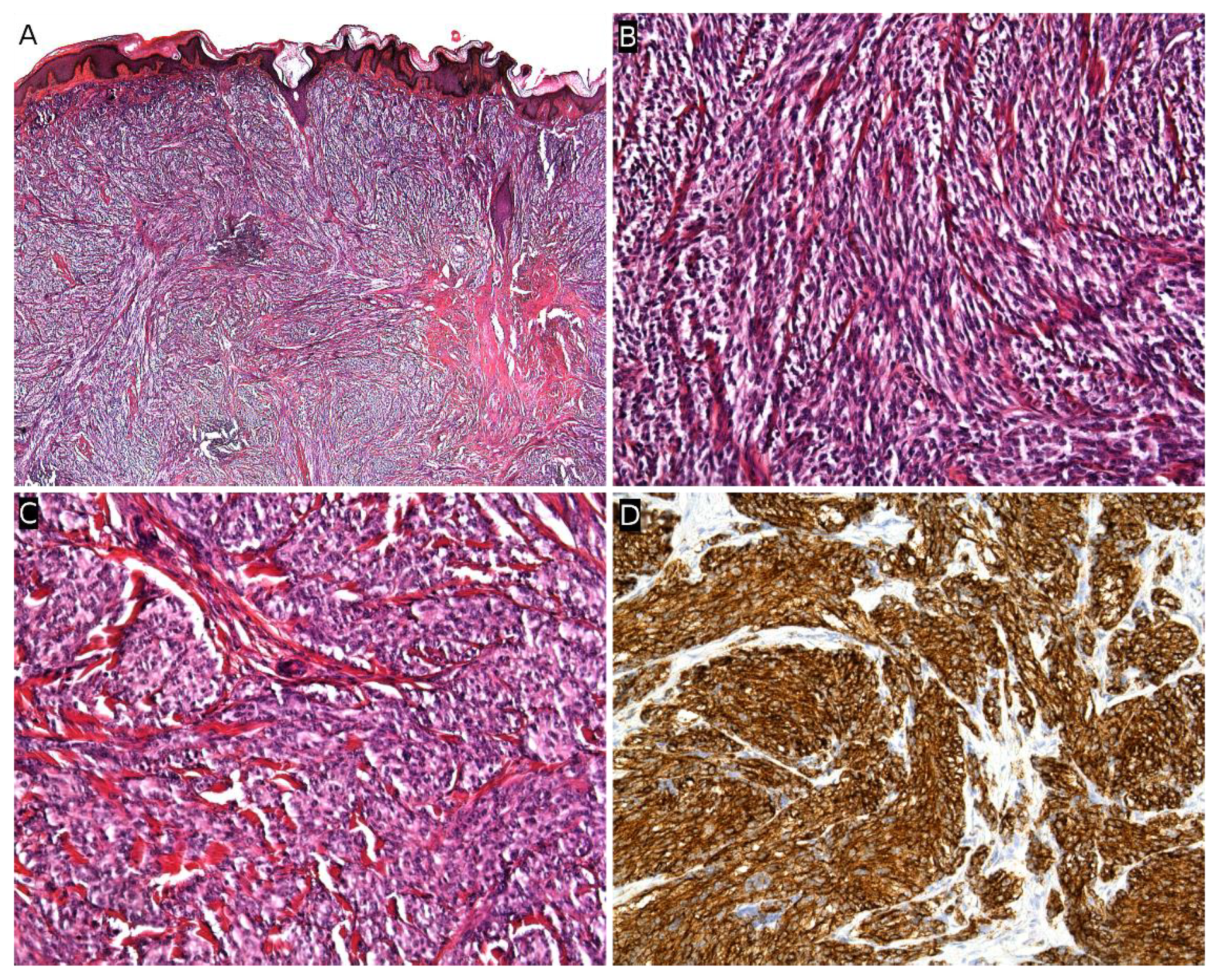 Cancers 14 02160 g016 Cancers 14 02160 g016