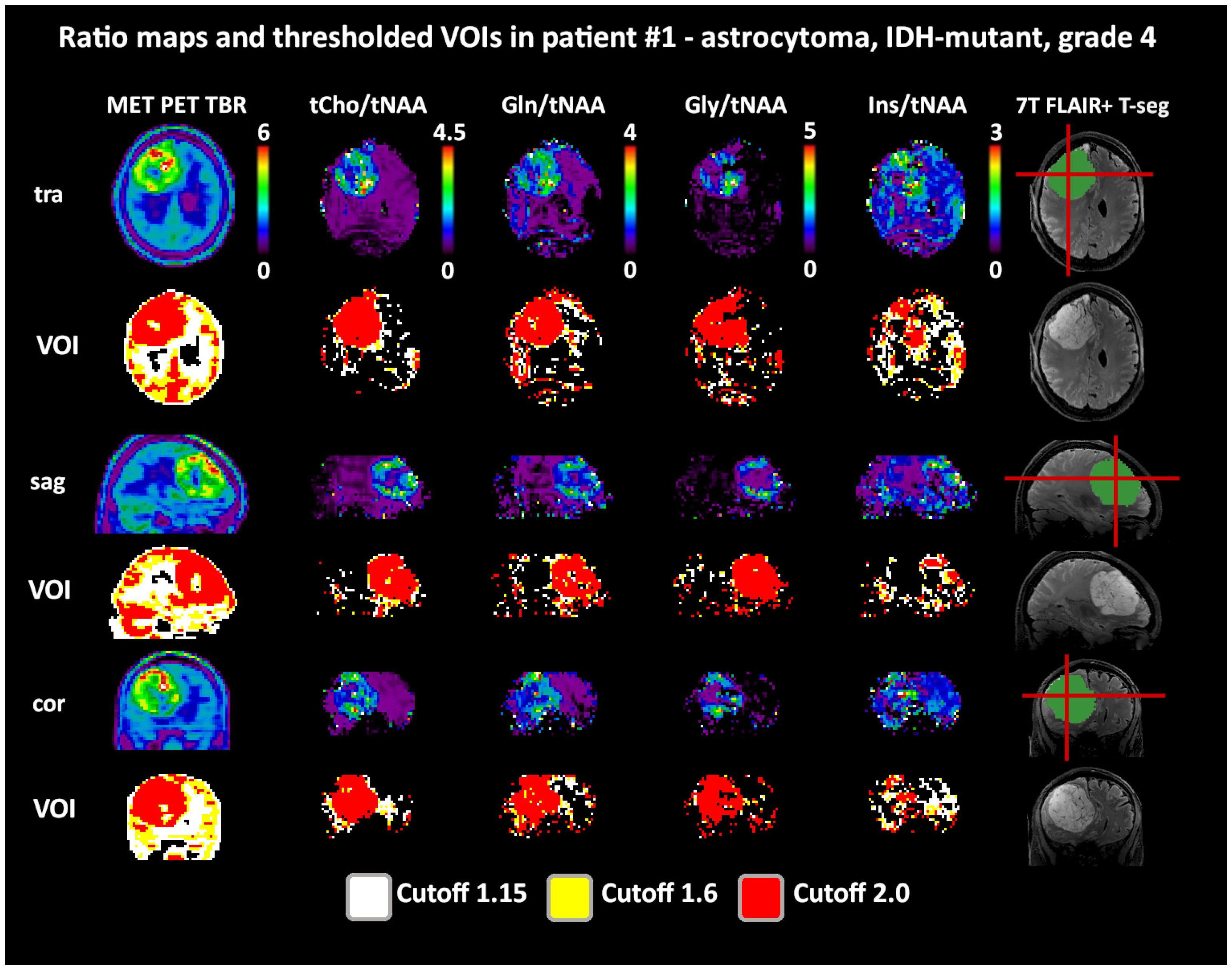 Cancers 14 02163 g004