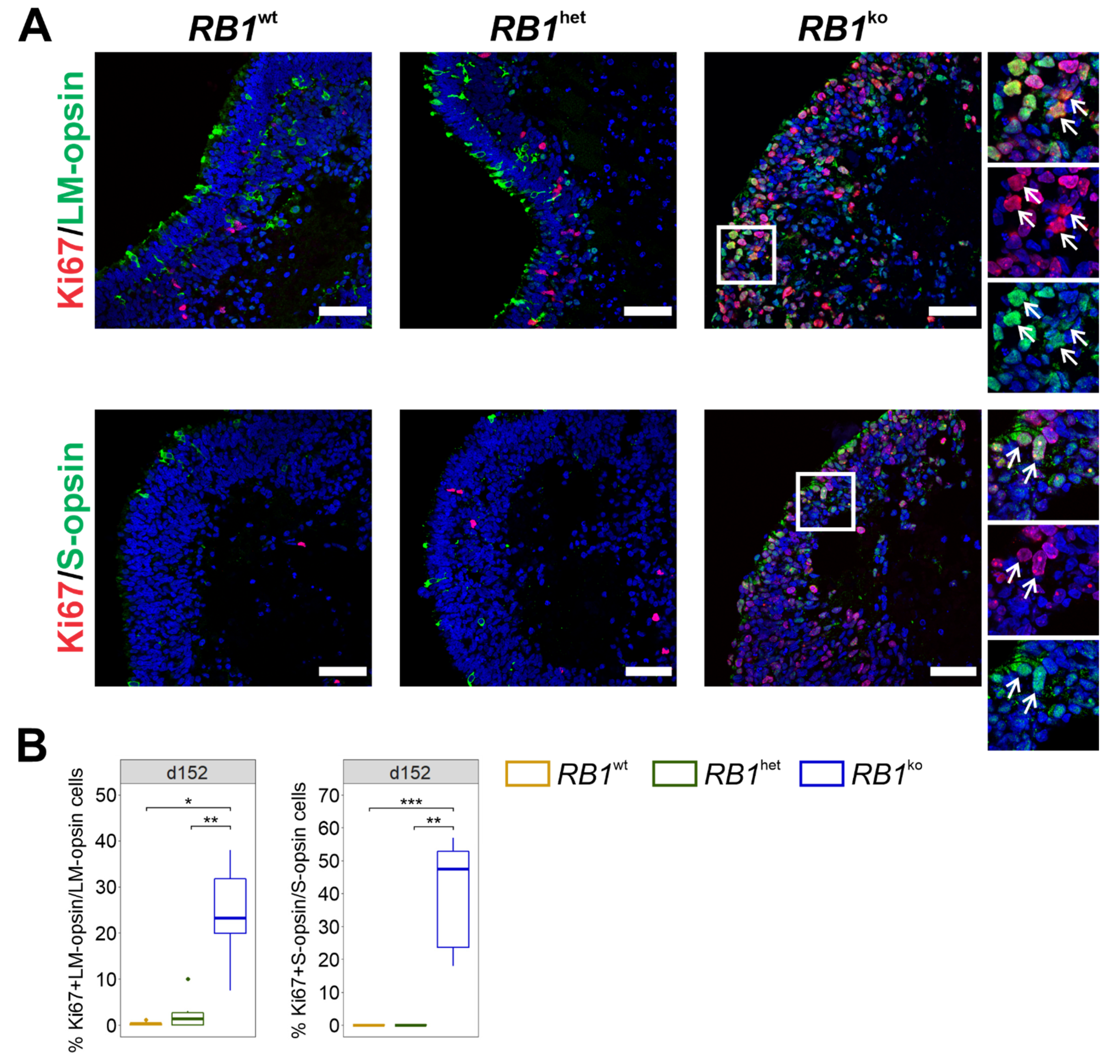Cancers 14 02166 g004