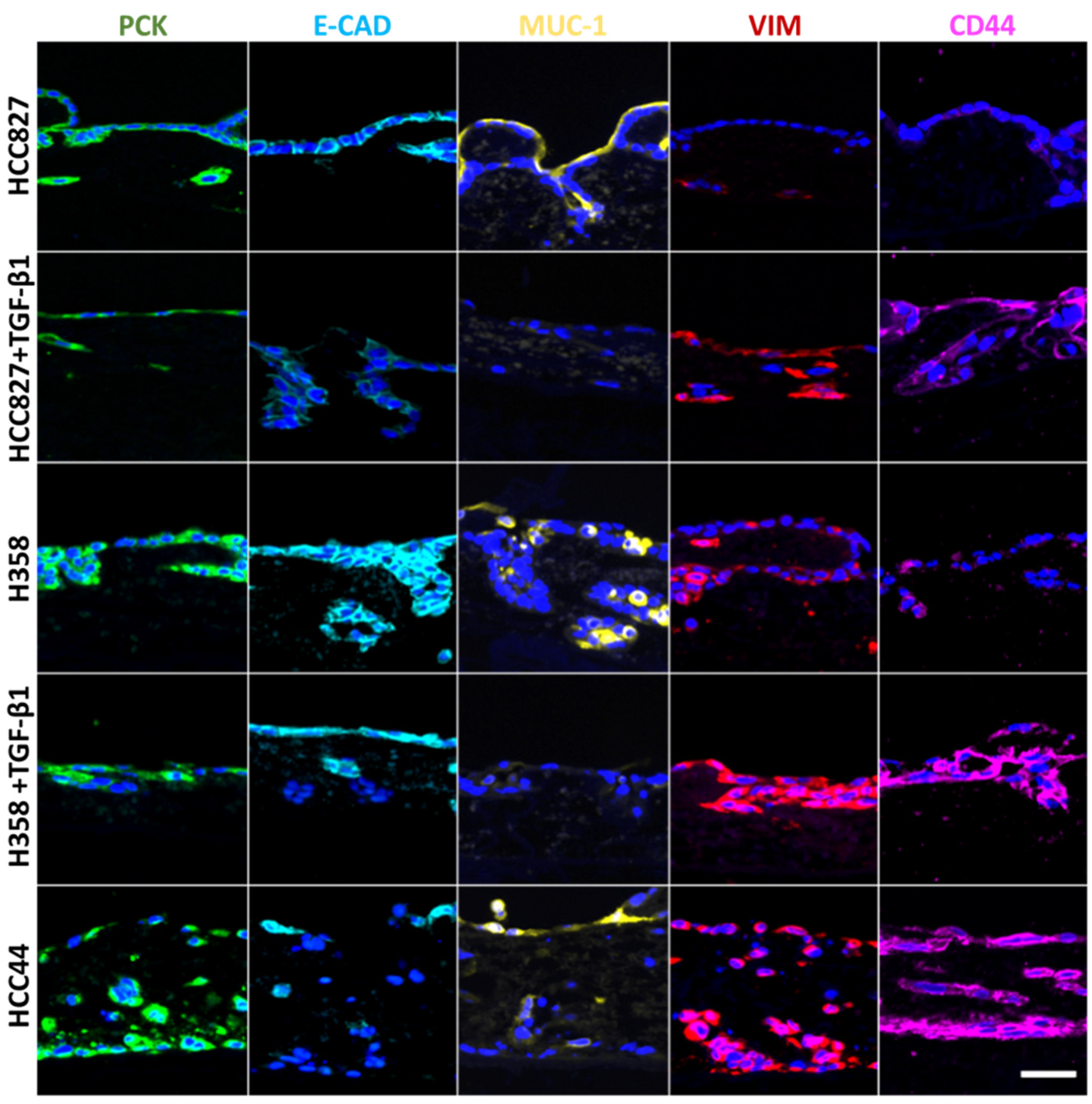 Cancers 14 02176 g002