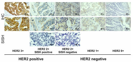 Cancers 14 02180 g0a2 550