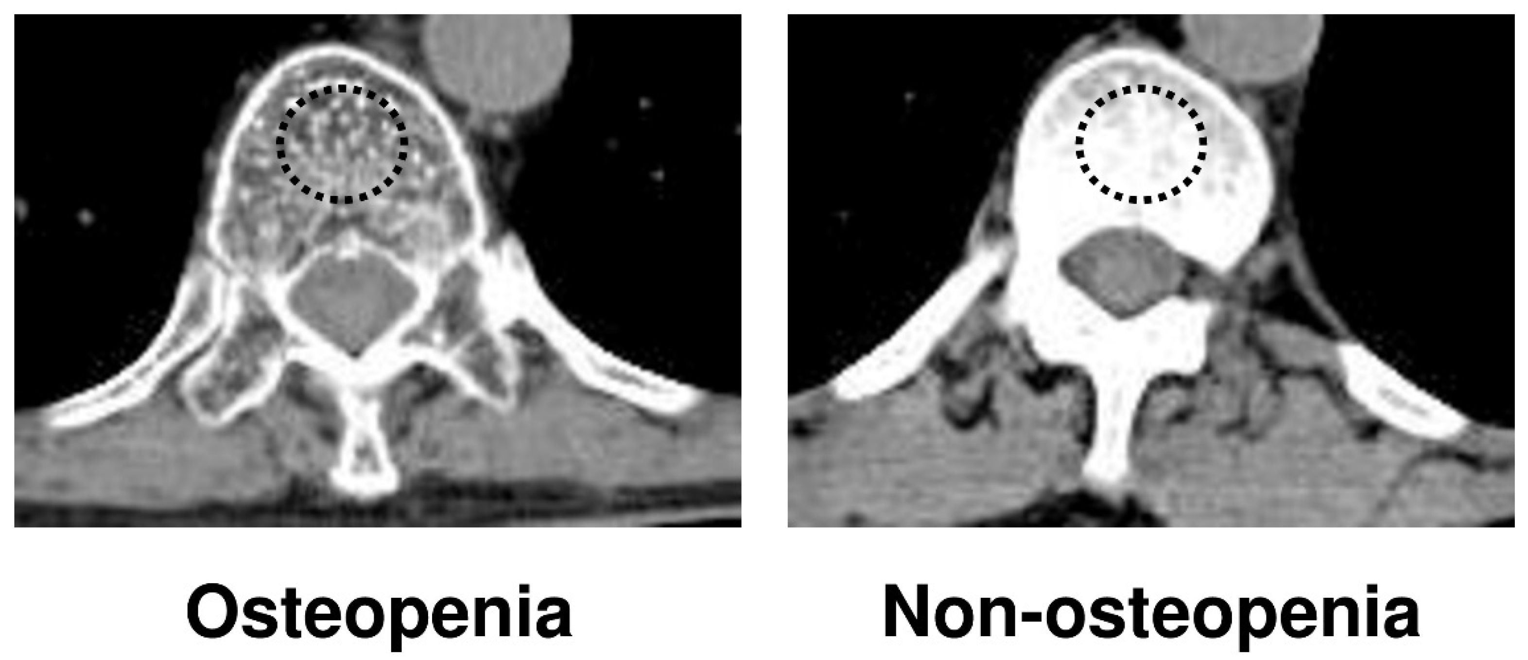 Cancers 14 02213 g001