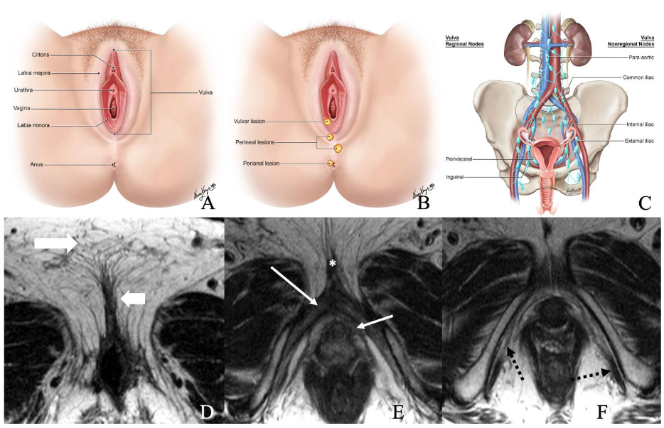 Cancers 14 02264 g001