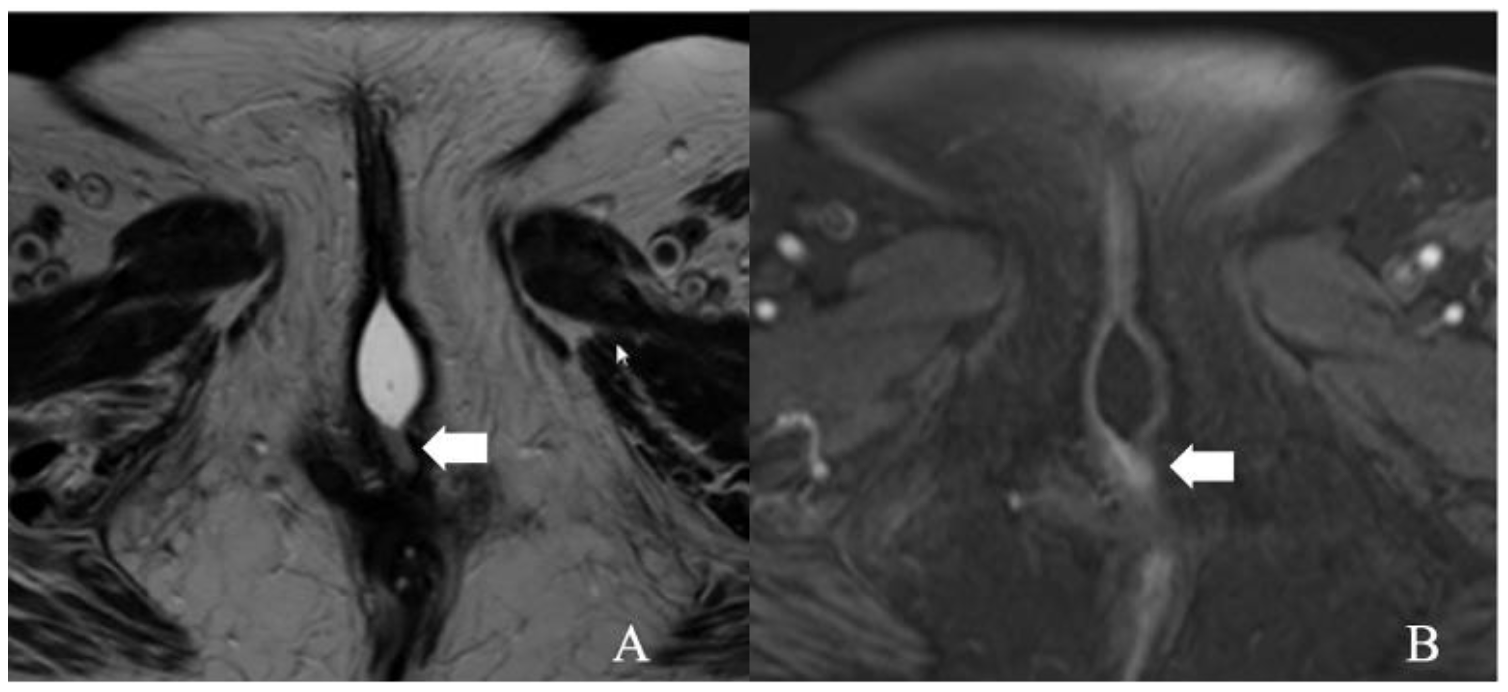 Cancers 14 02264 g003