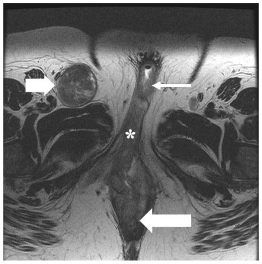 Cancers 14 02264 g006