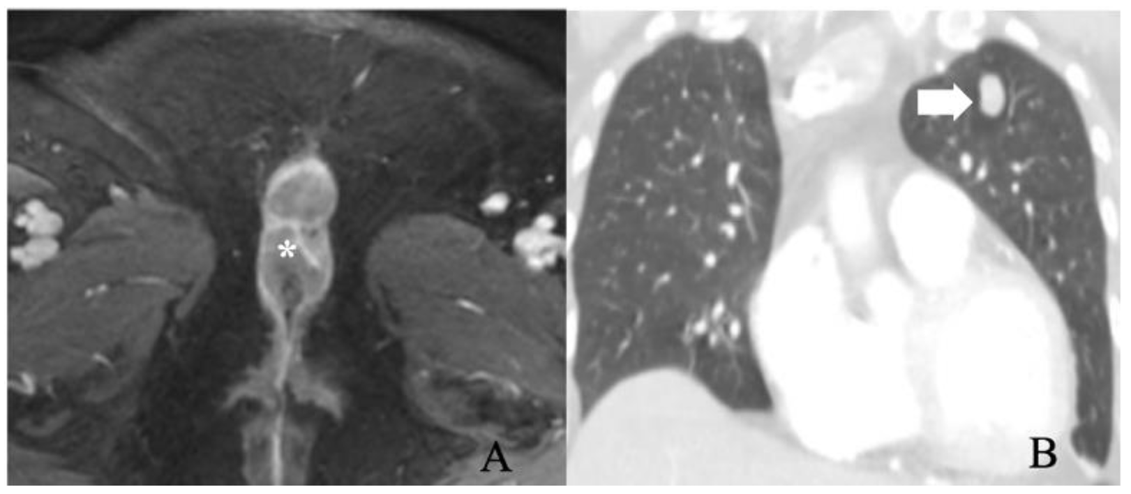 Cancers 14 02264 g007